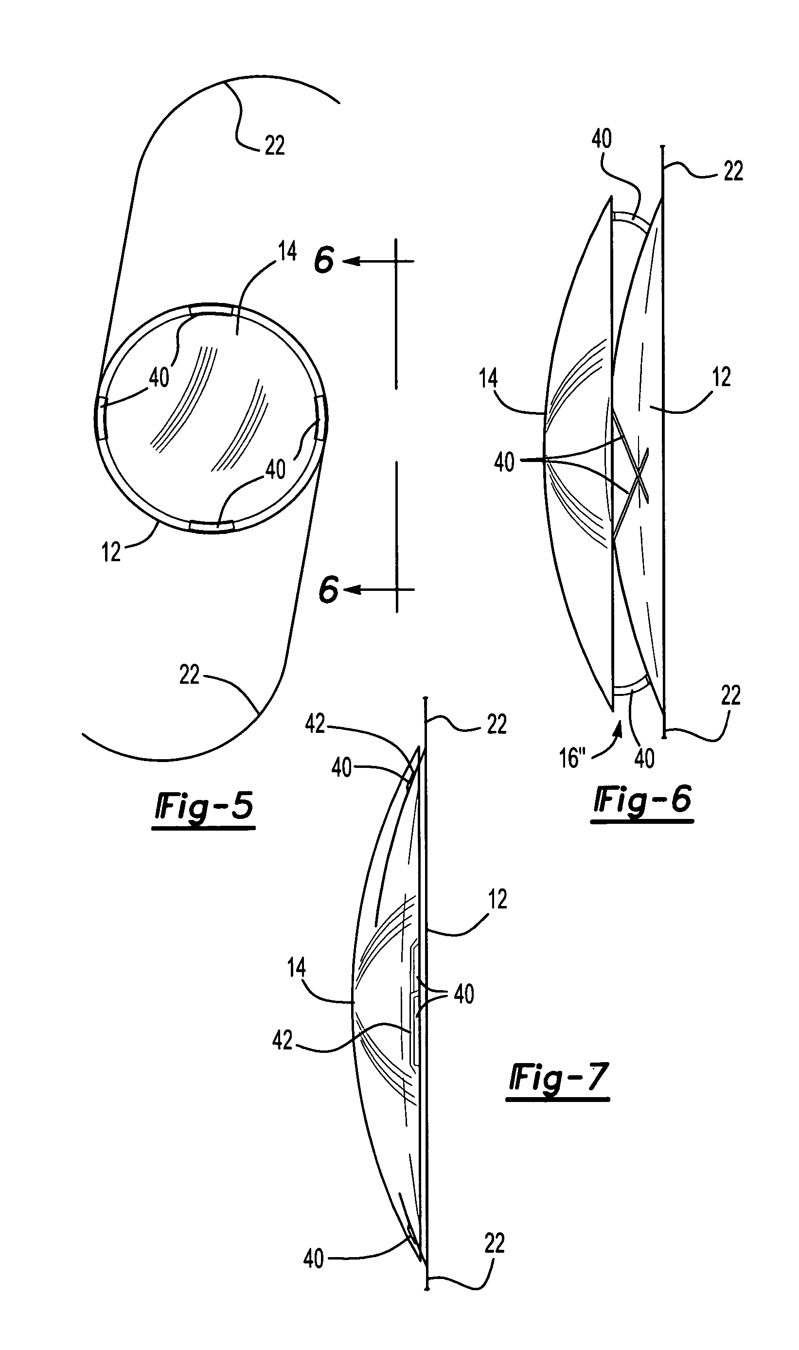 Posterior chamber lens implant