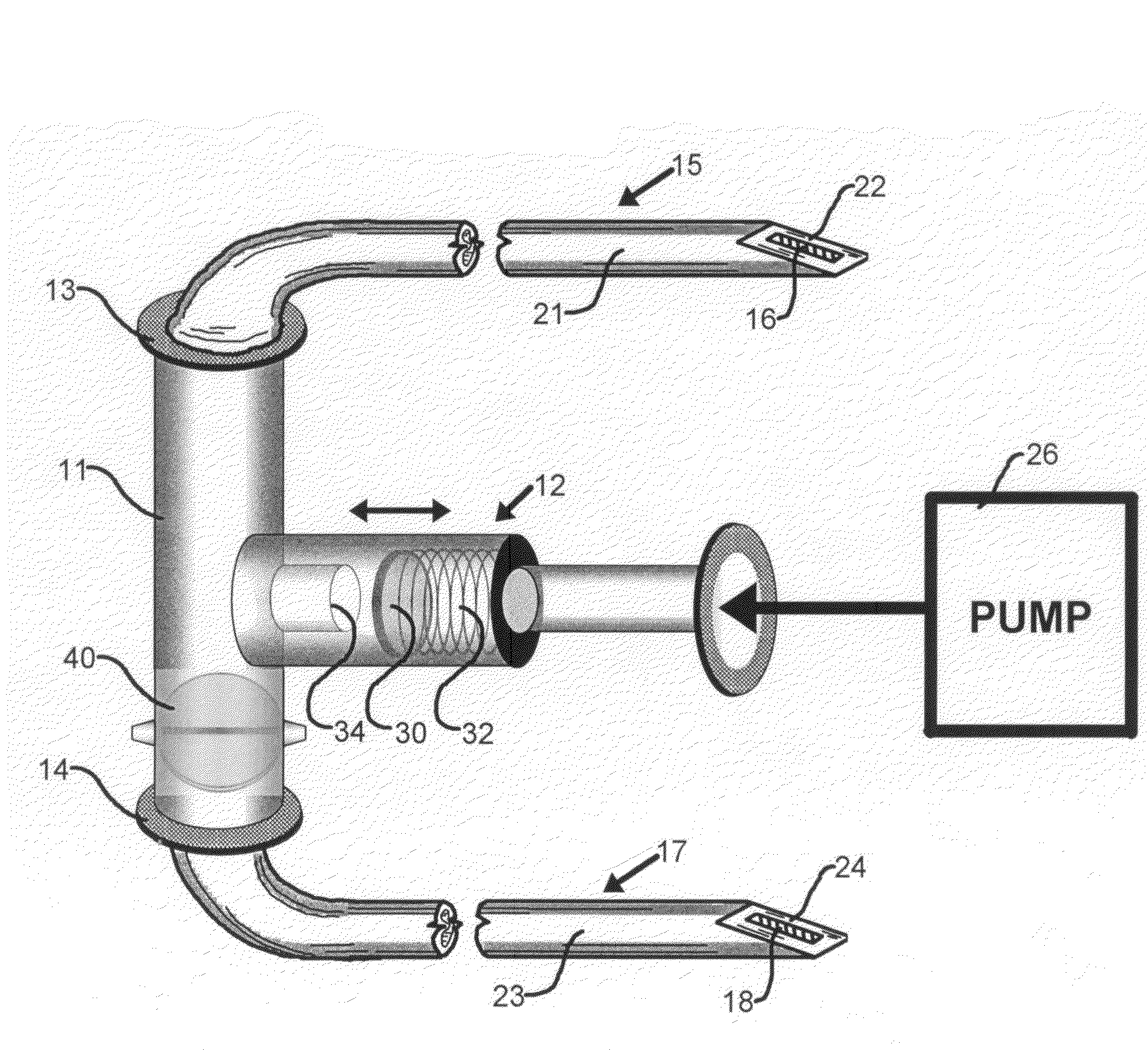 Alarm system for implantable pumps for intravenous drug delivery