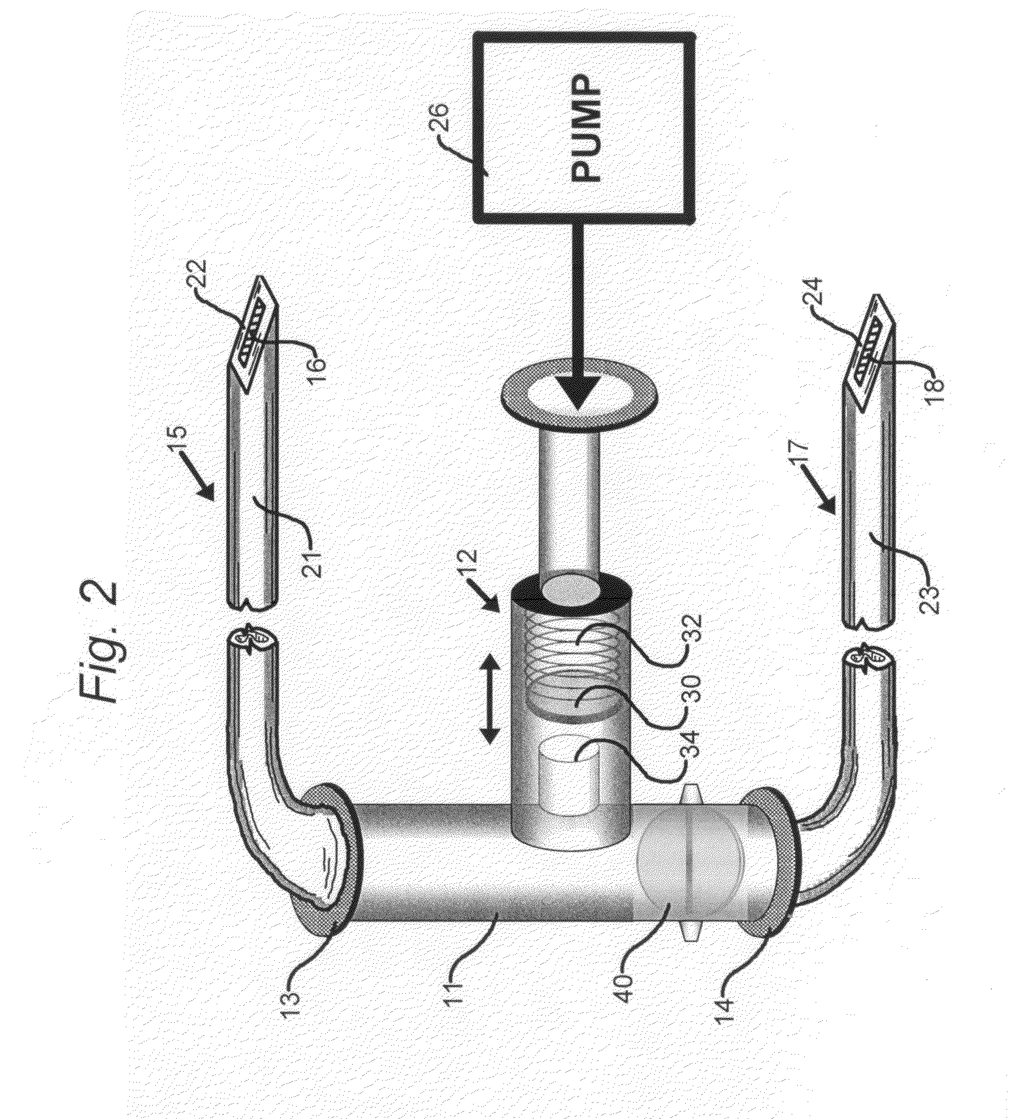 Alarm system for implantable pumps for intravenous drug delivery