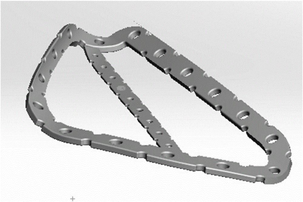 Anatomic plate for complicated scapula body fracture