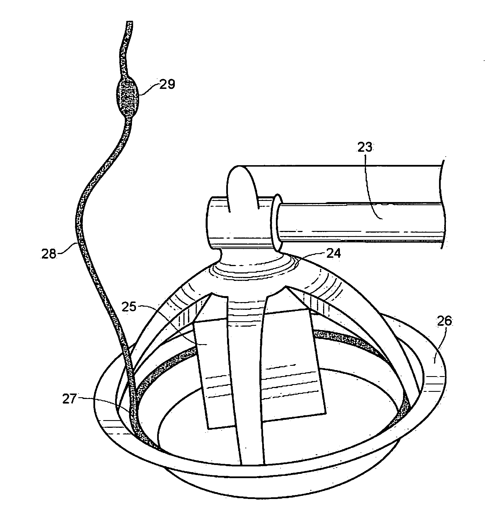 Methodology and Application of technology to keep animal feeding systems running maximum feed availability for the entire crop to grow more evenly and healthily