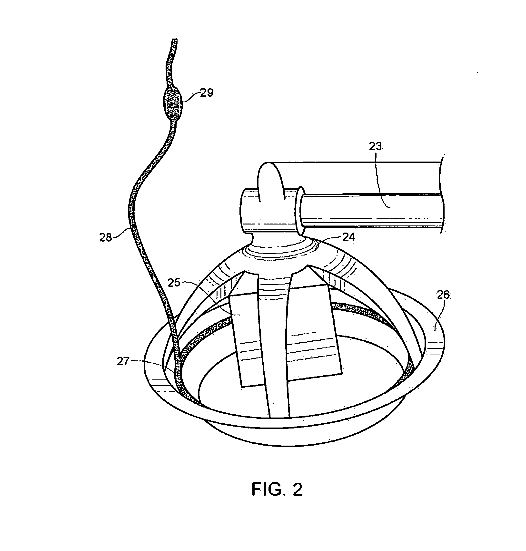 Methodology and Application of technology to keep animal feeding systems running maximum feed availability for the entire crop to grow more evenly and healthily