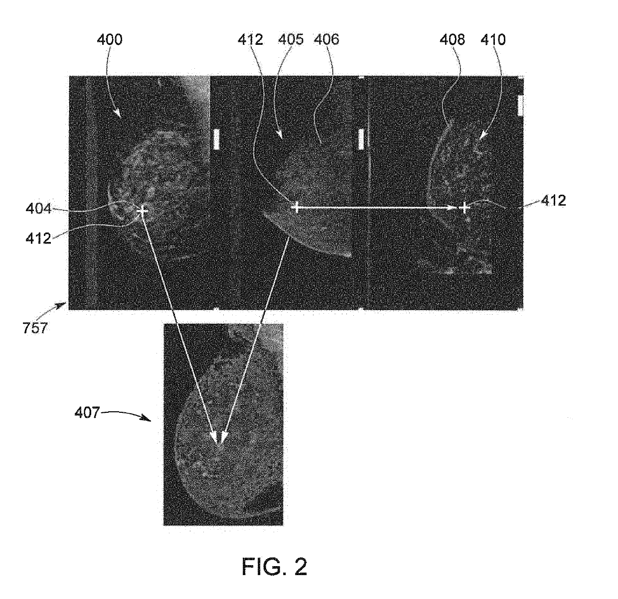 Multimodality 2D To 3D Imaging Navigation