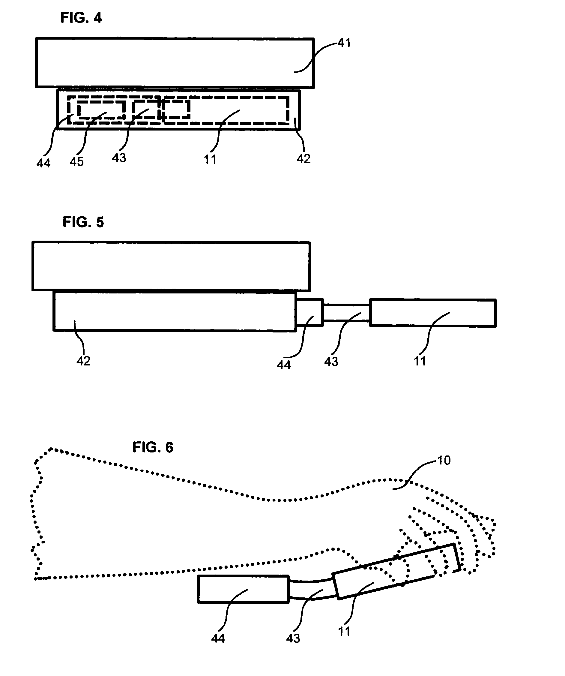 Flexion-discouraging splint system, method and device