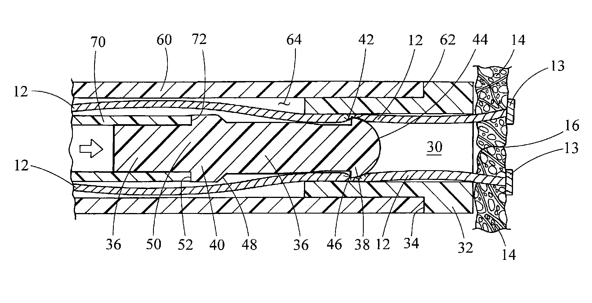 Suture lock