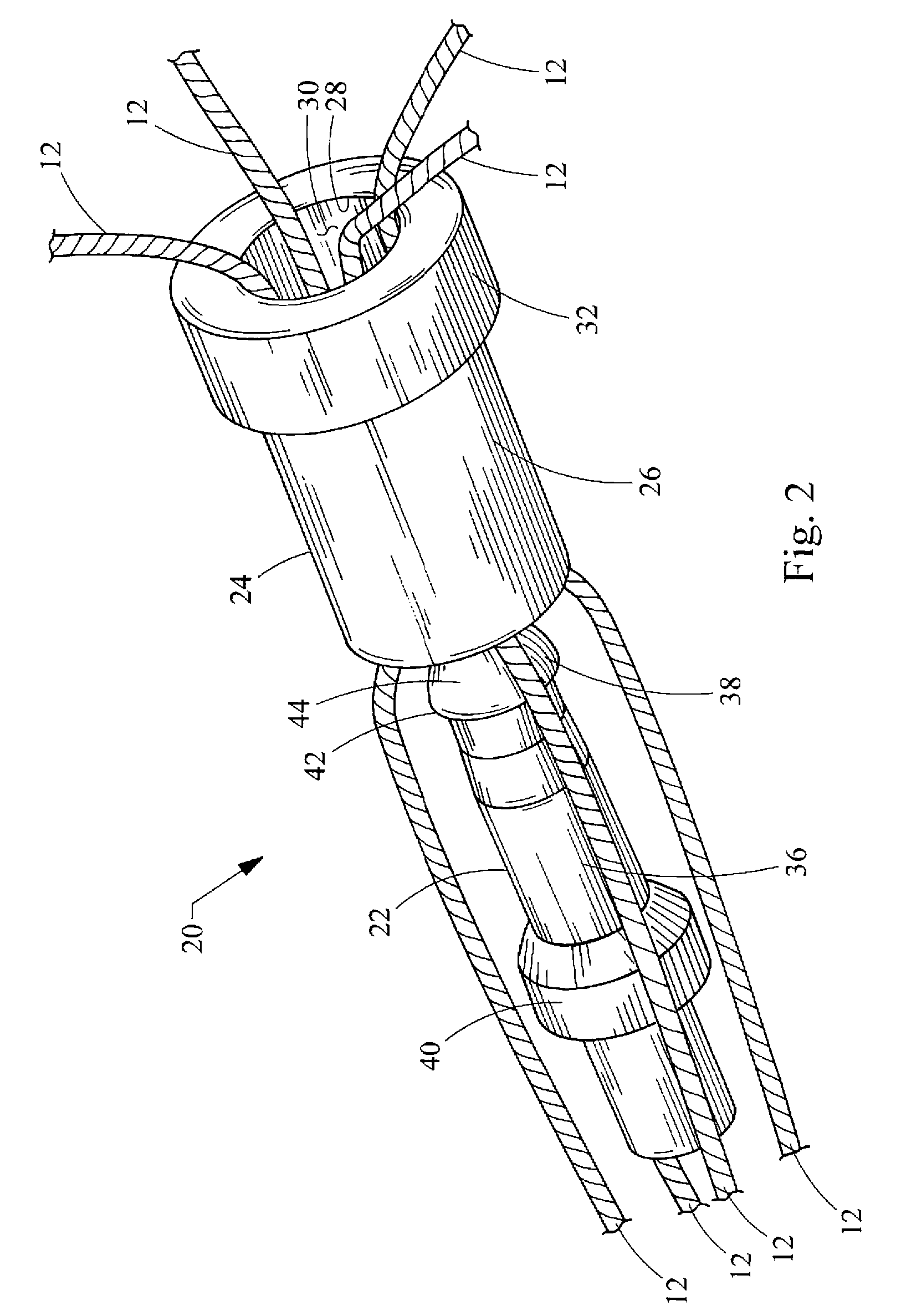 Suture lock