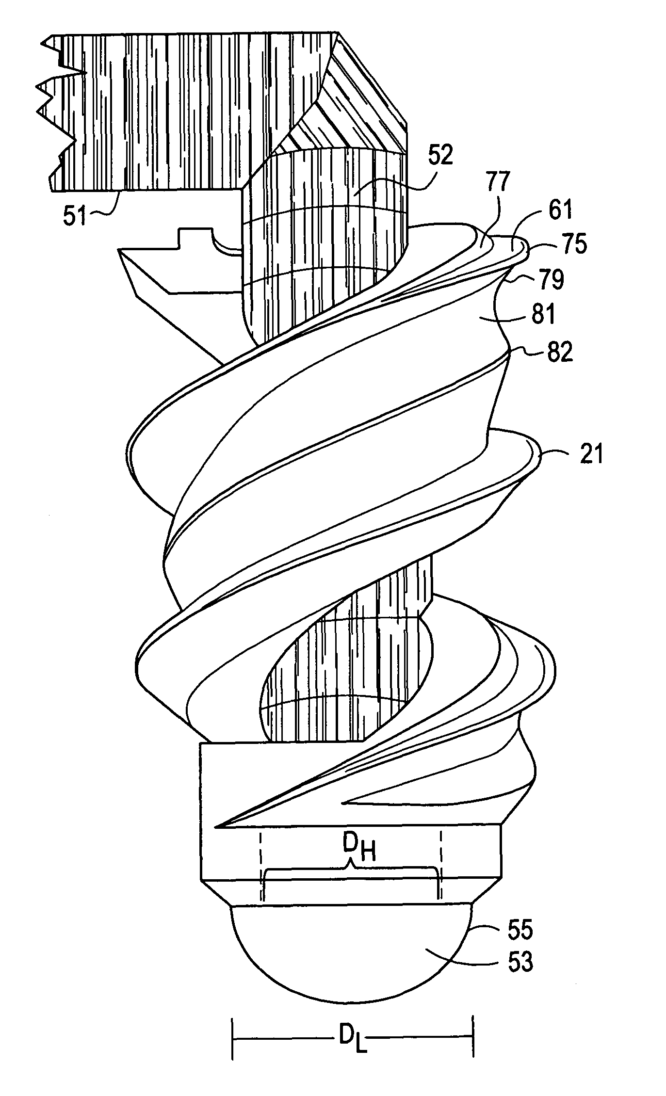 Intervertebral ligament having a helical bone fastener