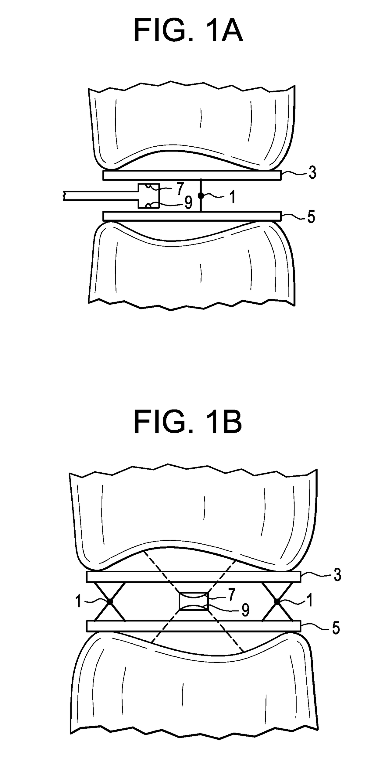 Patient-Specific Spinal Fusion Cage and Methods of Making Same