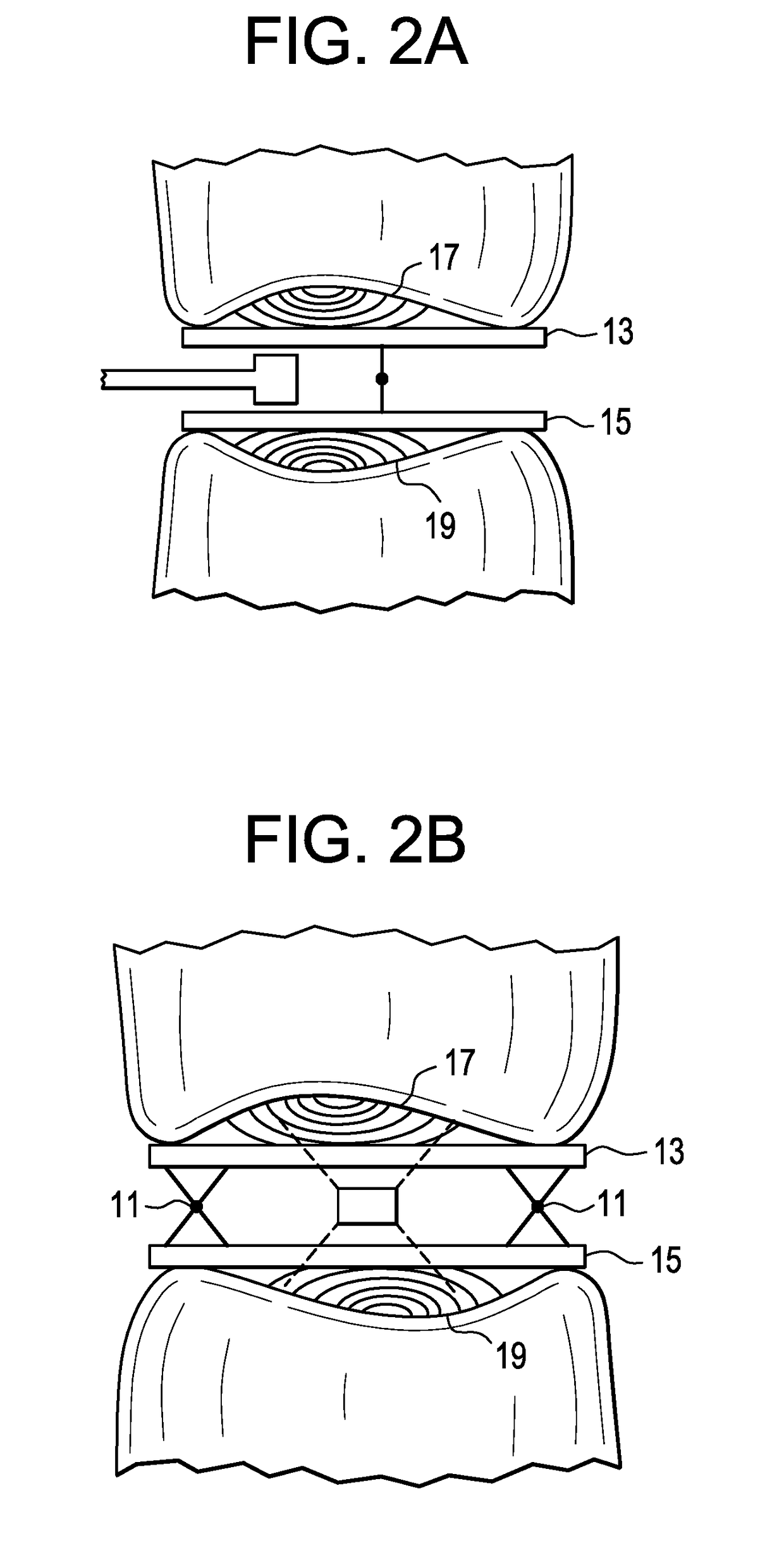 Patient-Specific Spinal Fusion Cage and Methods of Making Same
