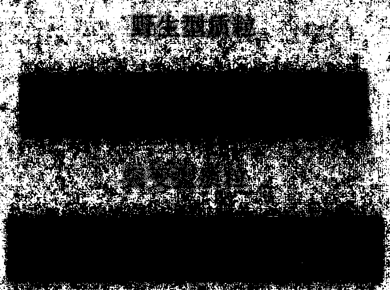 Gene detection chip of common mutations of diphosphate glucuronyl transferase 1A and use method thereof