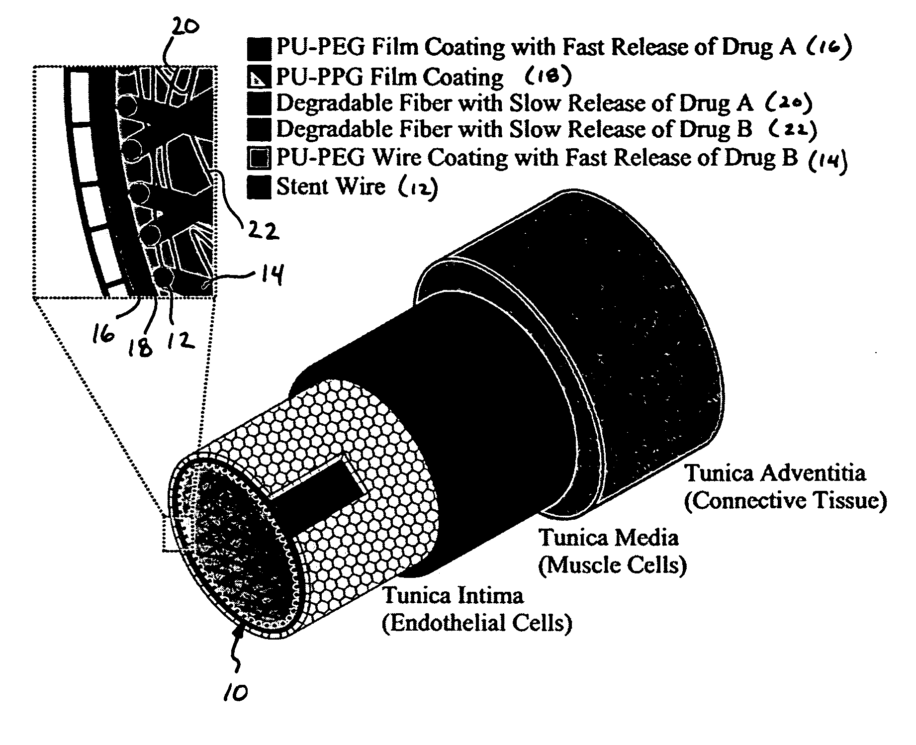 Barrier stent and use thereof