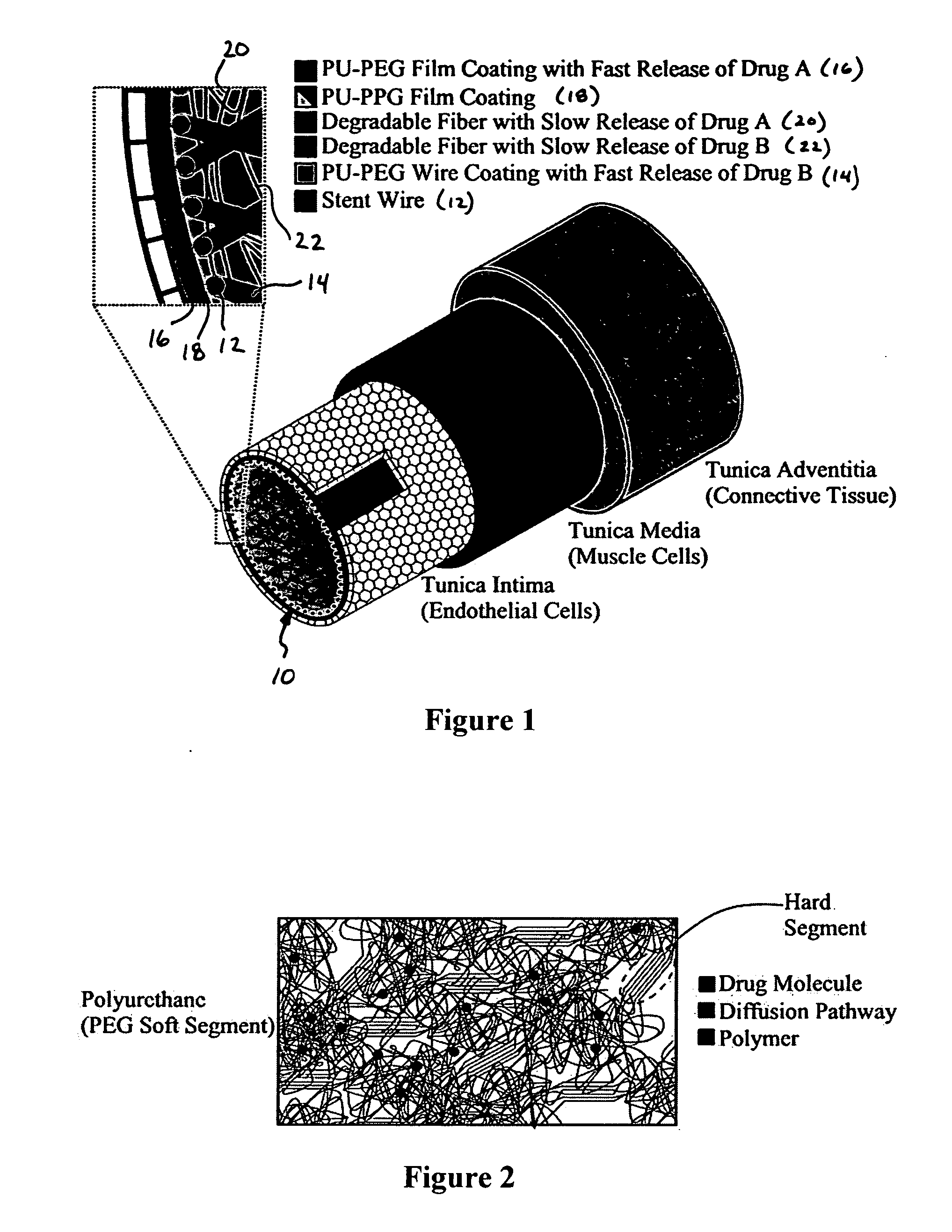 Barrier stent and use thereof