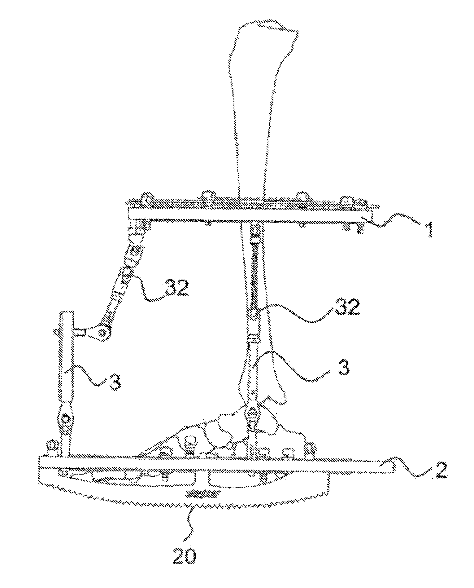 External fixator system