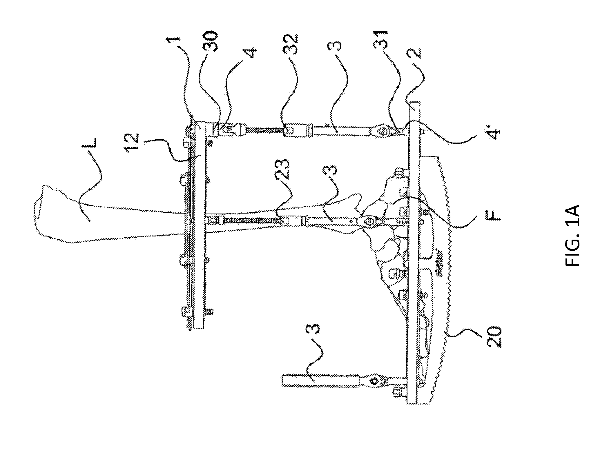 External fixator system