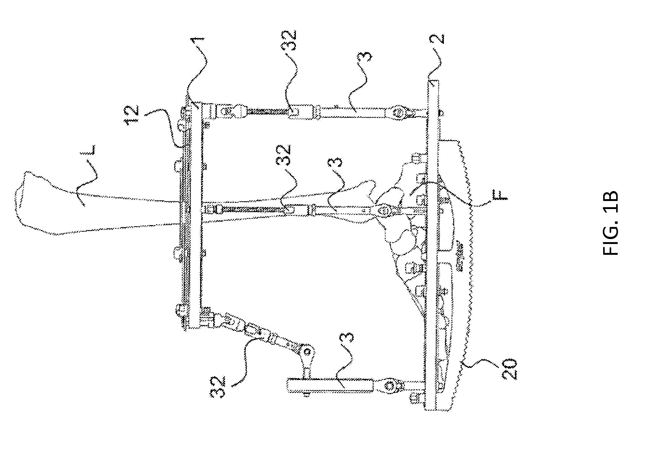 External fixator system