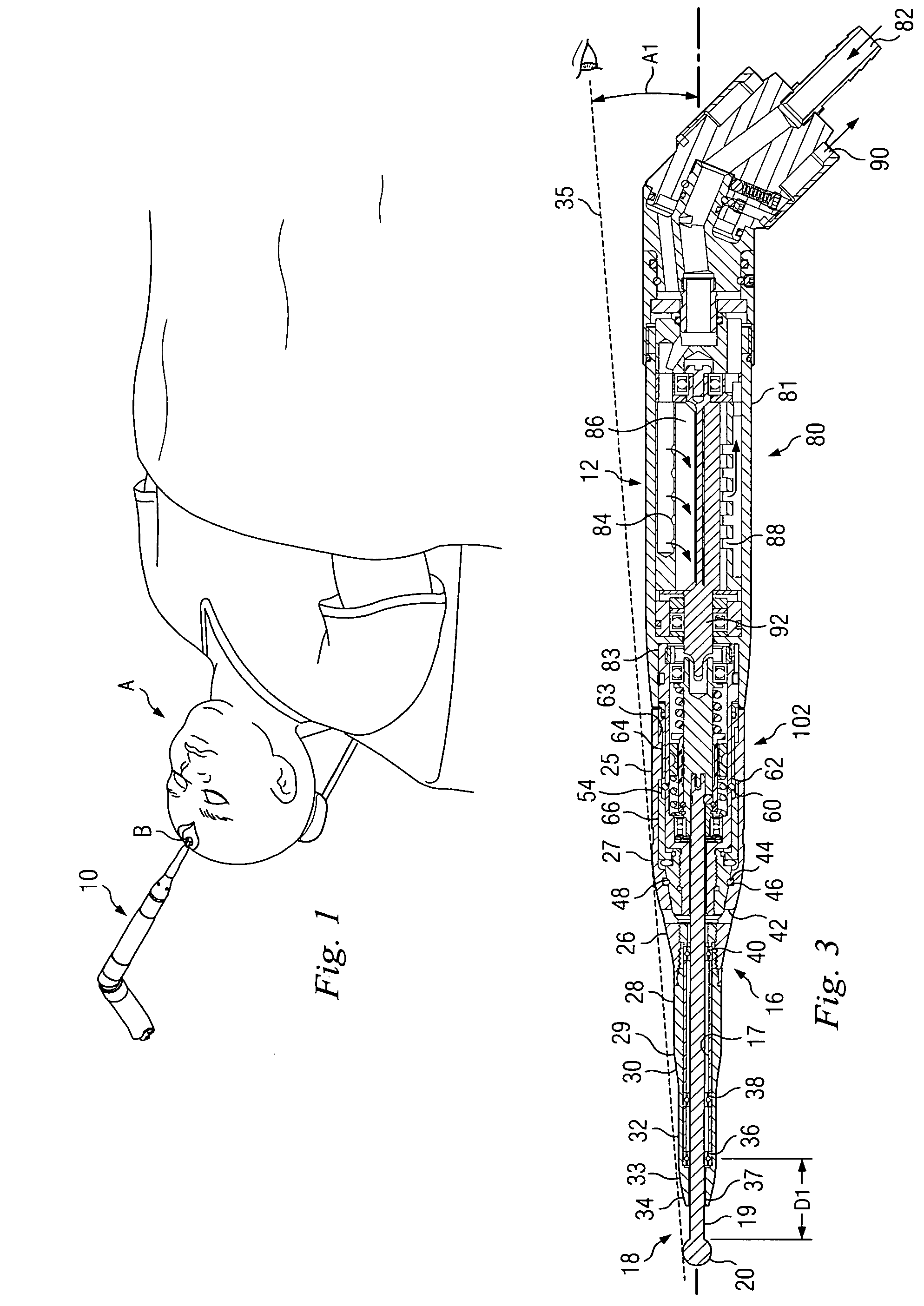 Surgical instrument with rotary cutting member and quick release coupling arrangement