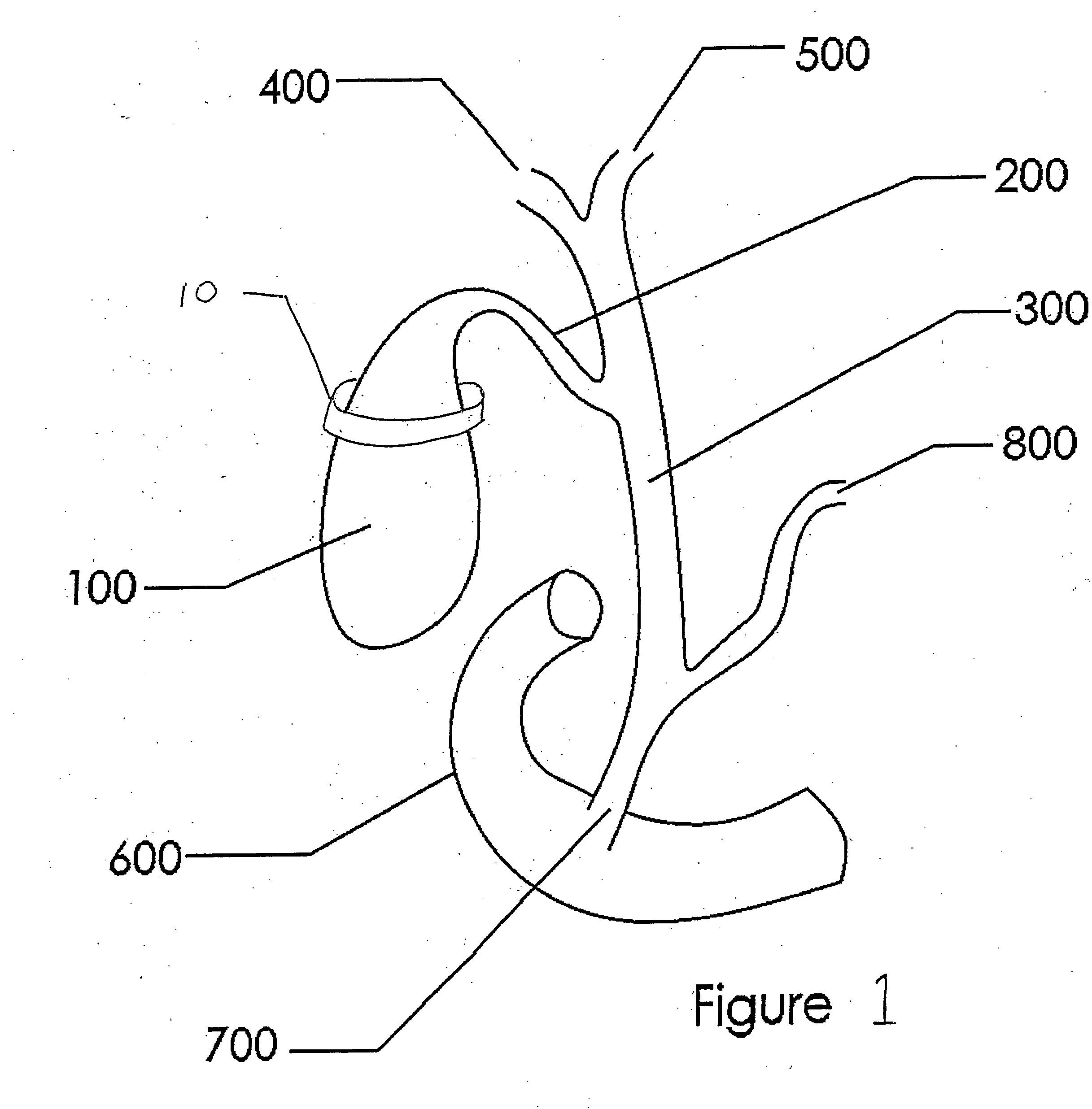 Methods and devices for treating obesity