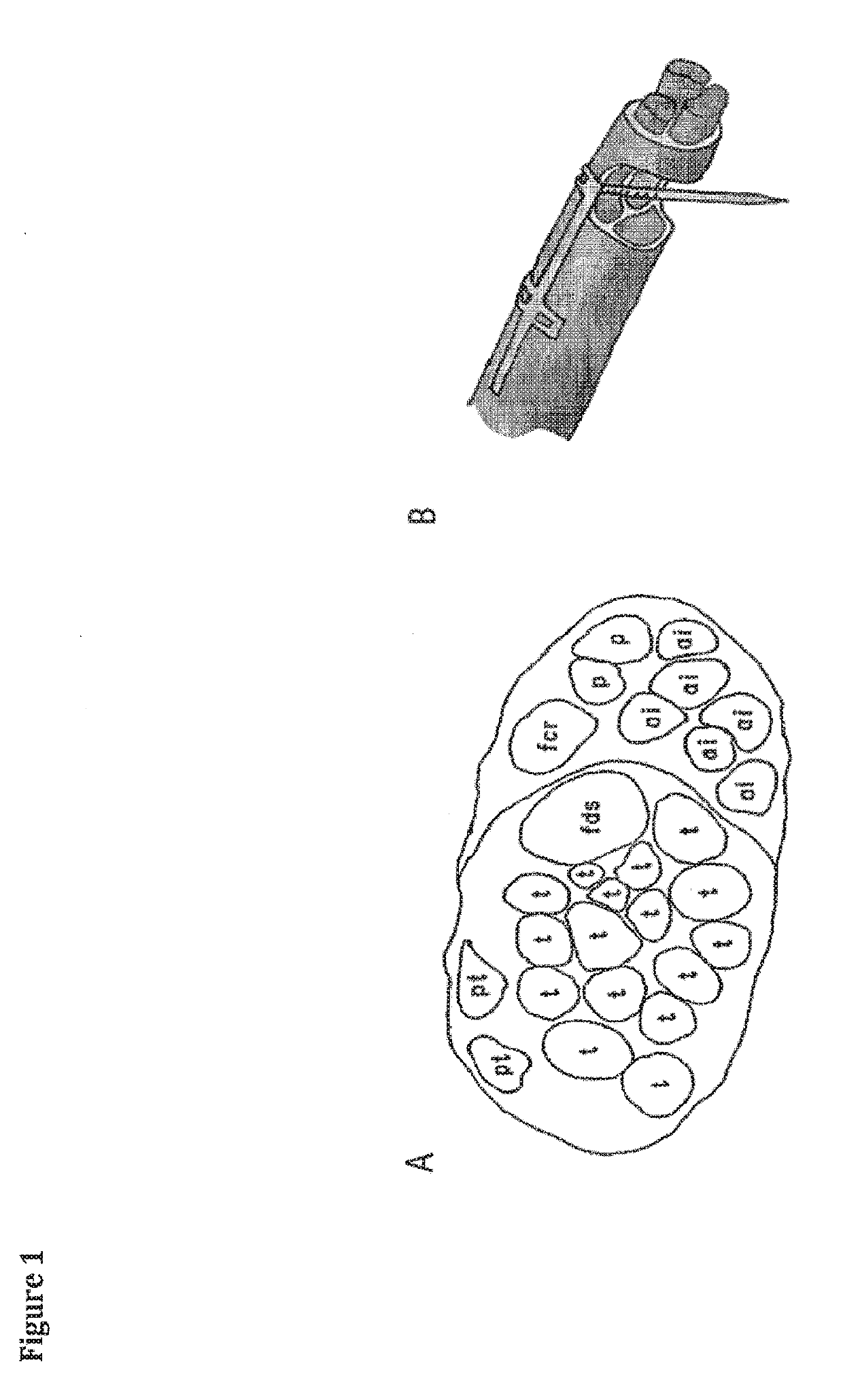 Bidirectional limb neuro-prosthesis