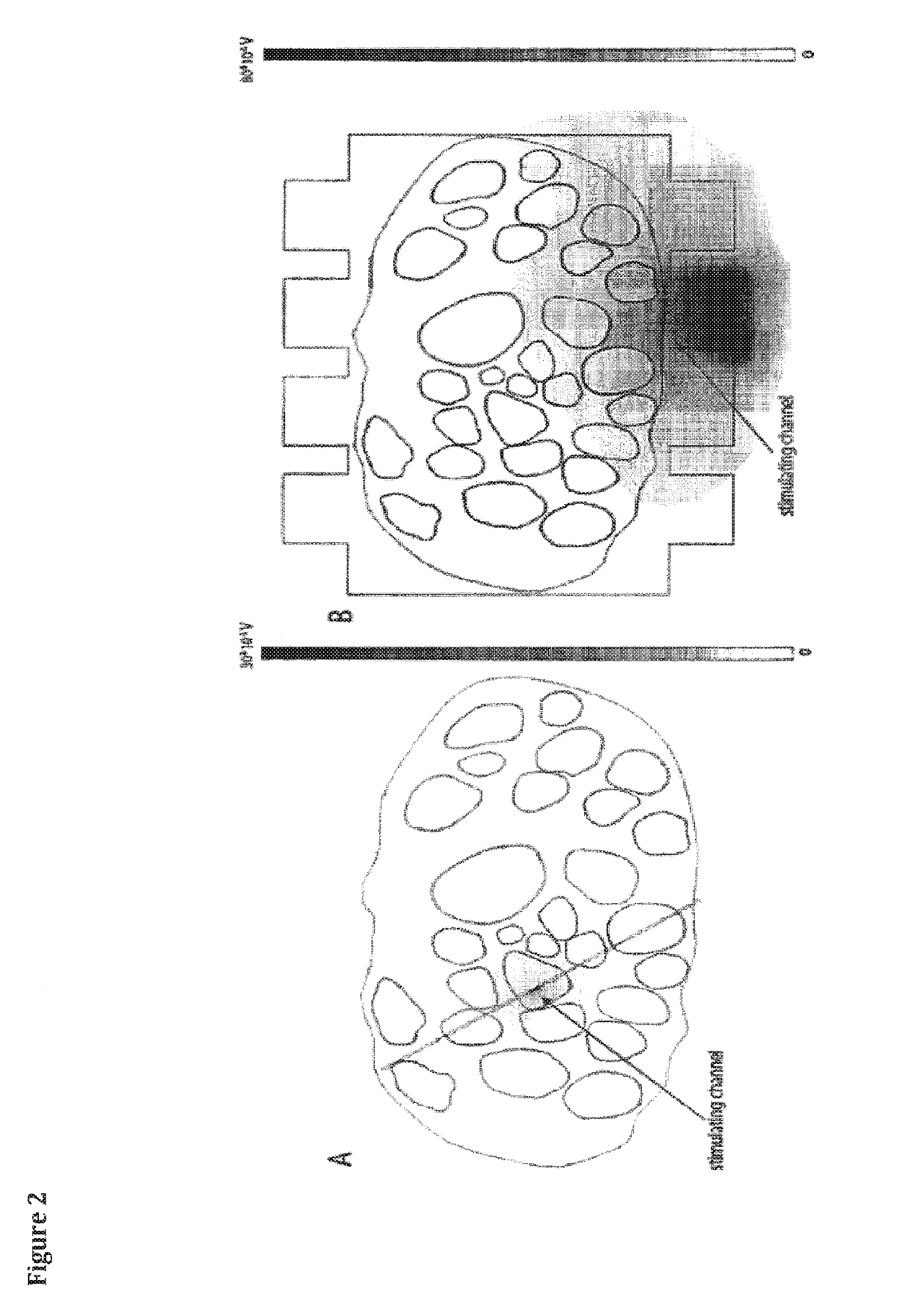 Bidirectional limb neuro-prosthesis