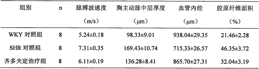 Application of antihypertensive drug prepared by zidovudine