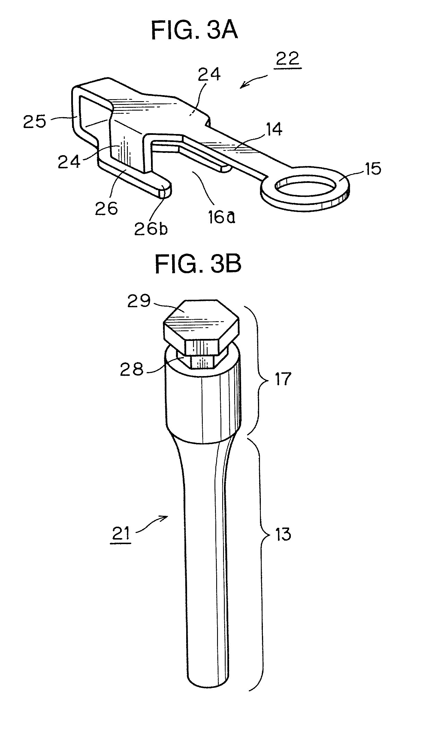 Orthodontic supporting structure