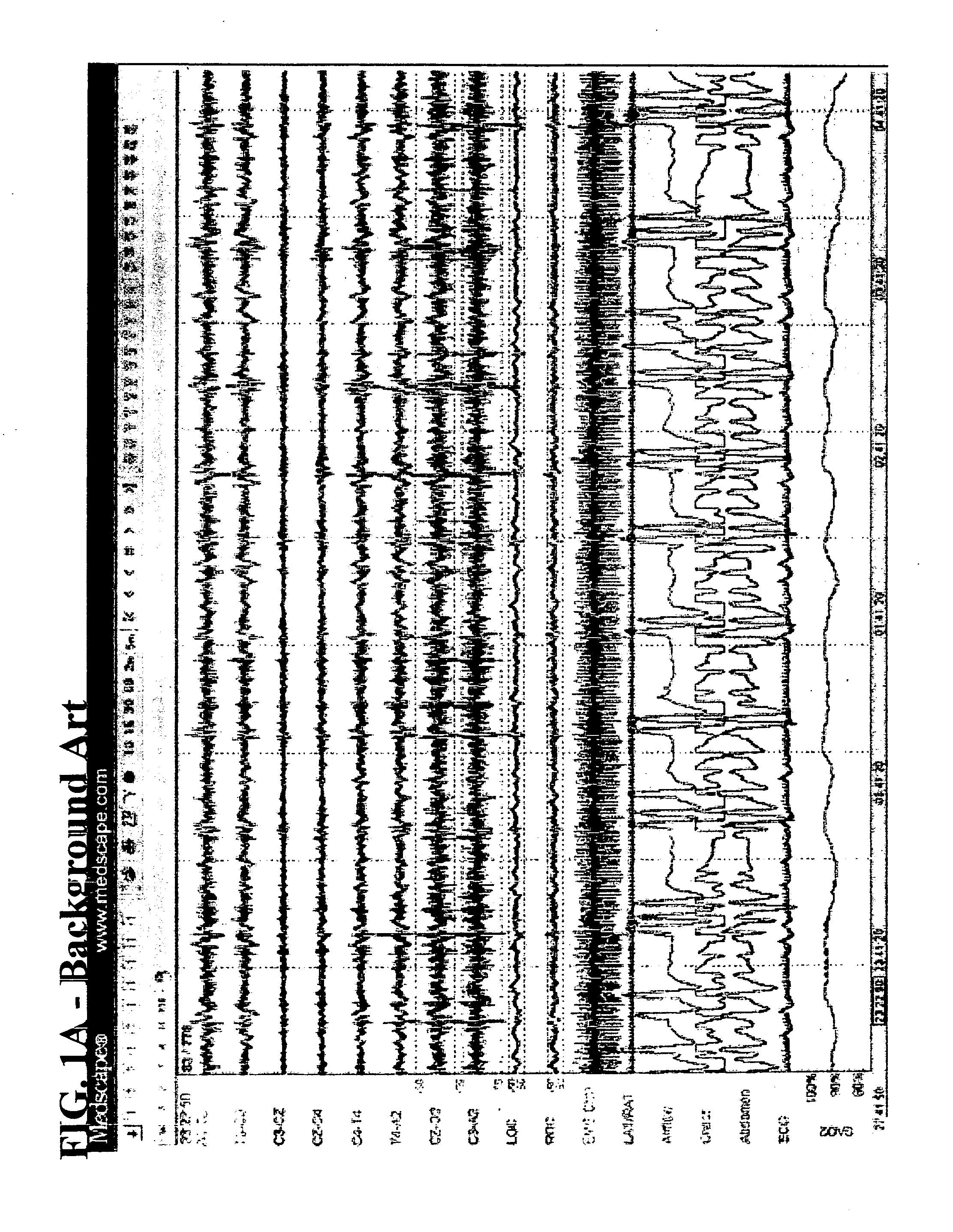 System and method for assessment of sleep