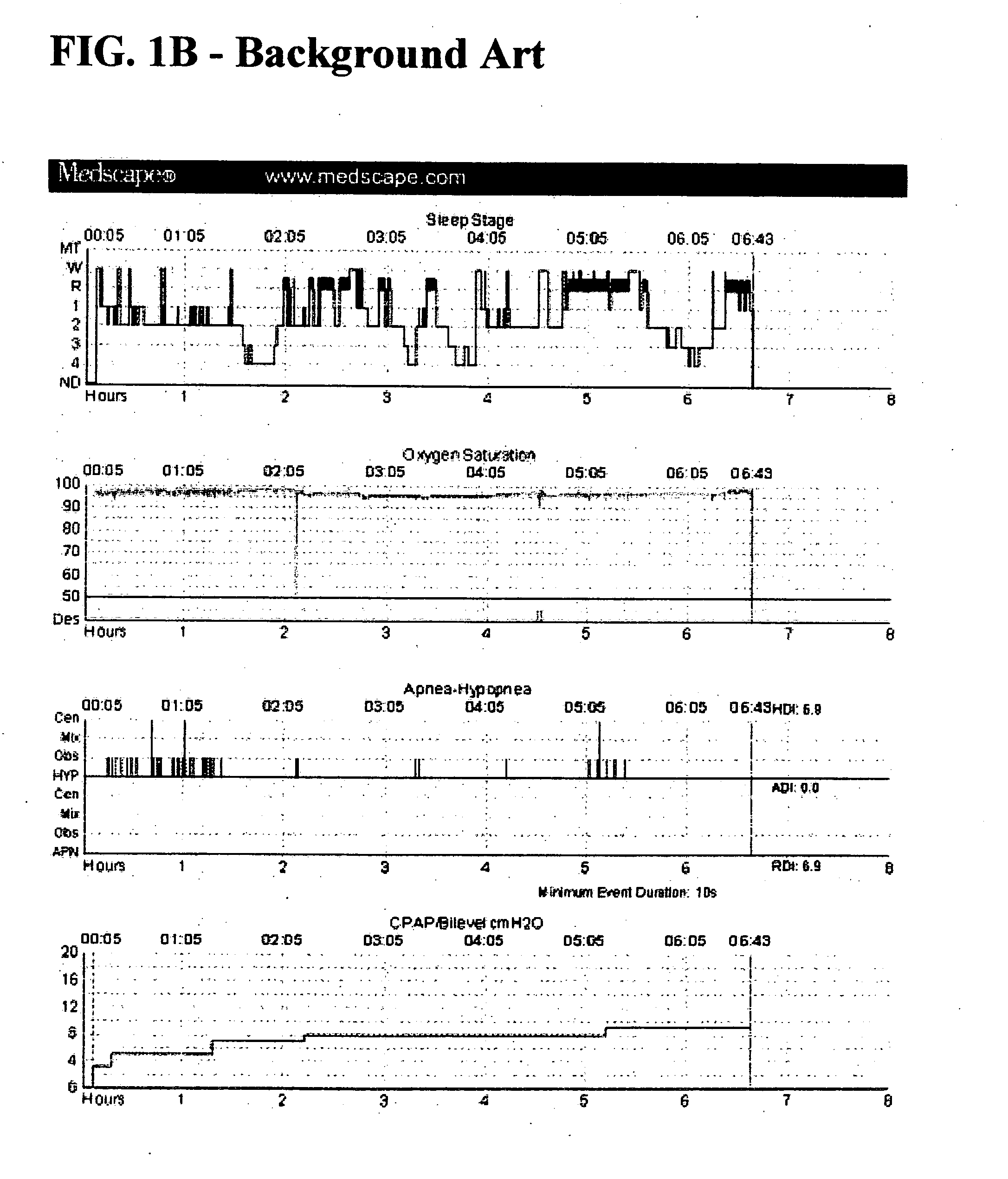 System and method for assessment of sleep