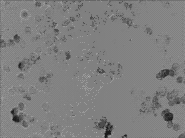 In-situ hybridization detection kit and detection method for liver cancer precancer NOTCH1 on mRNA (messenger ribonucleic acid) level, and applications thereof