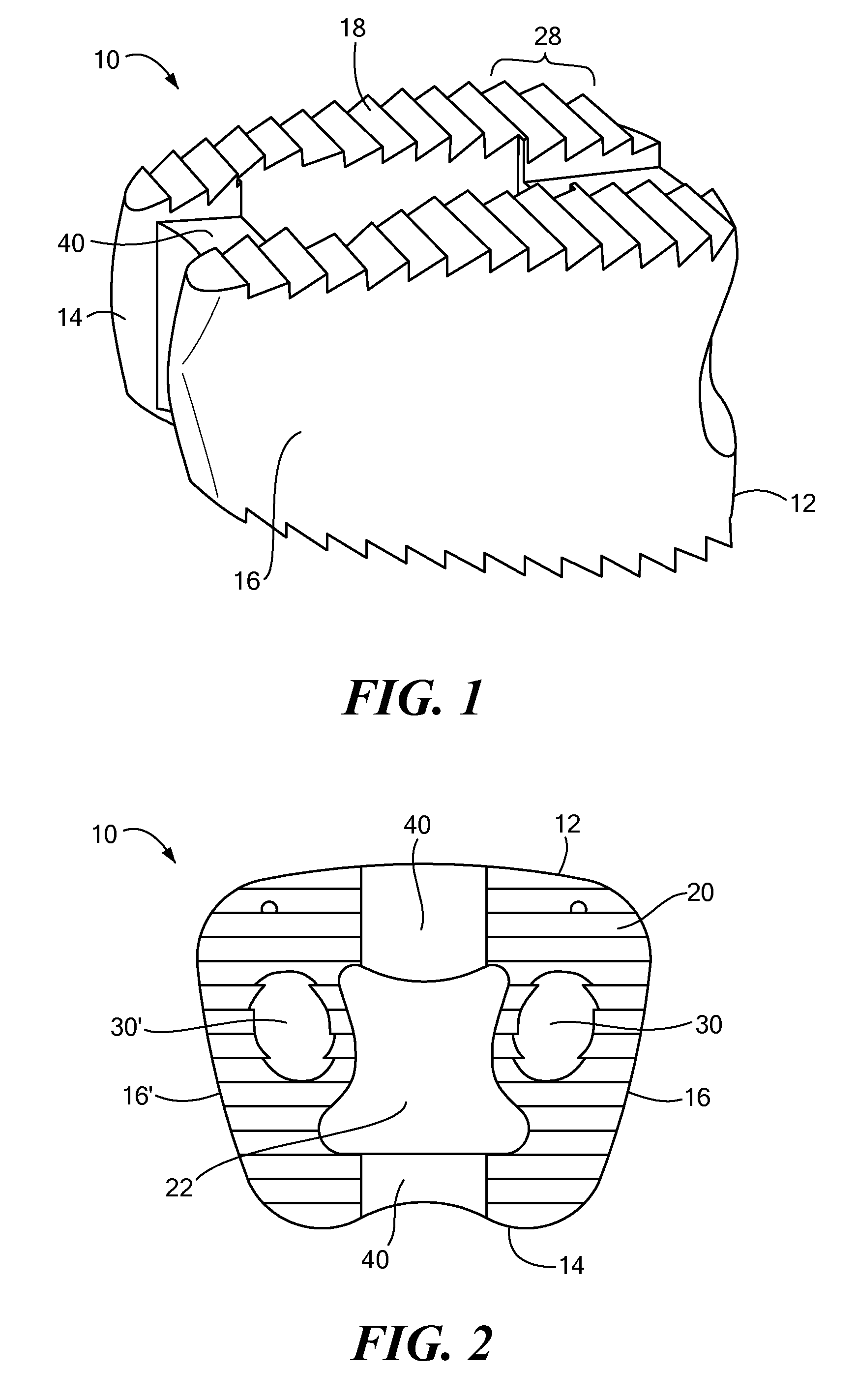 Spinal implant with biologic sponge