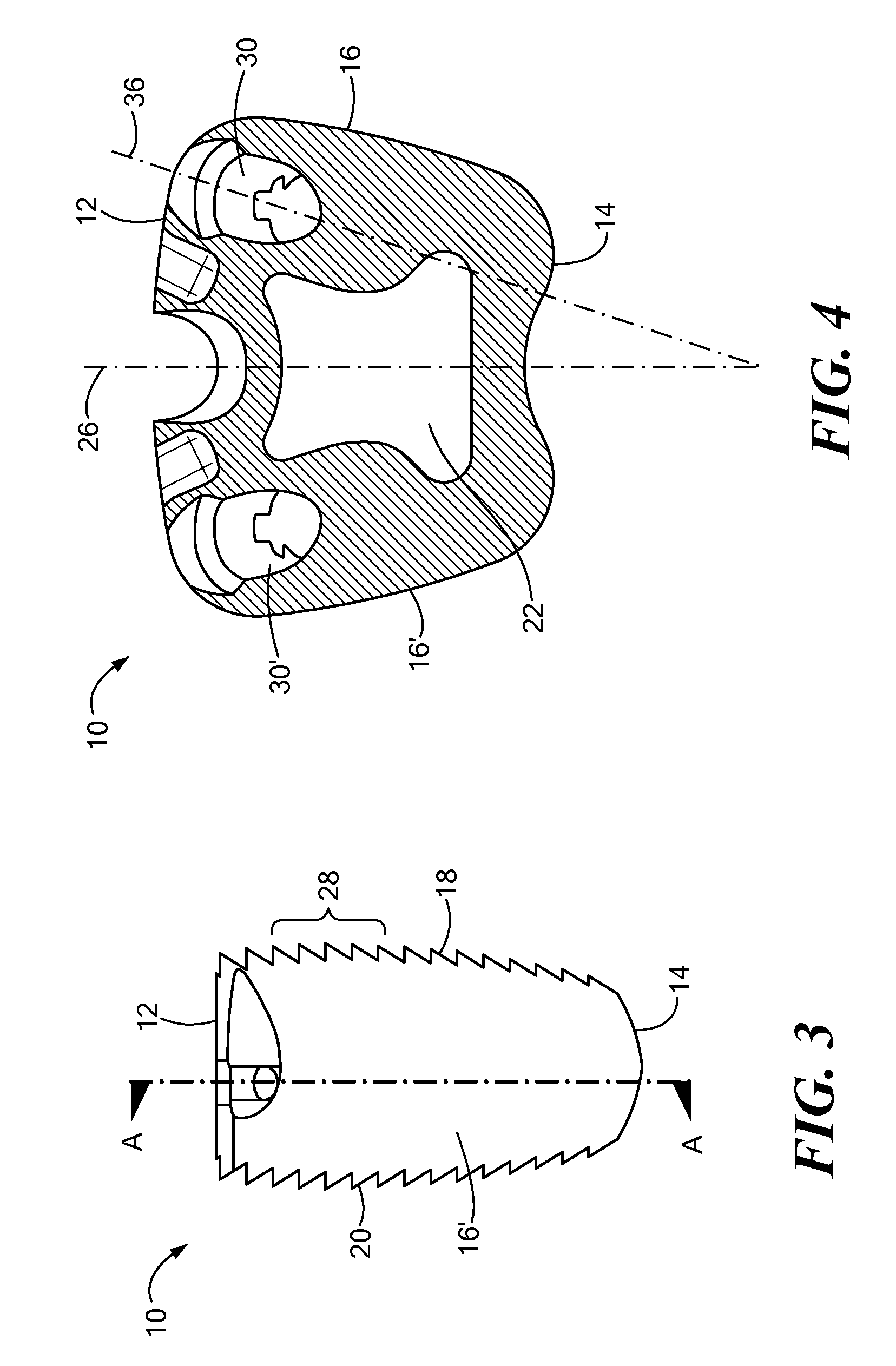 Spinal implant with biologic sponge