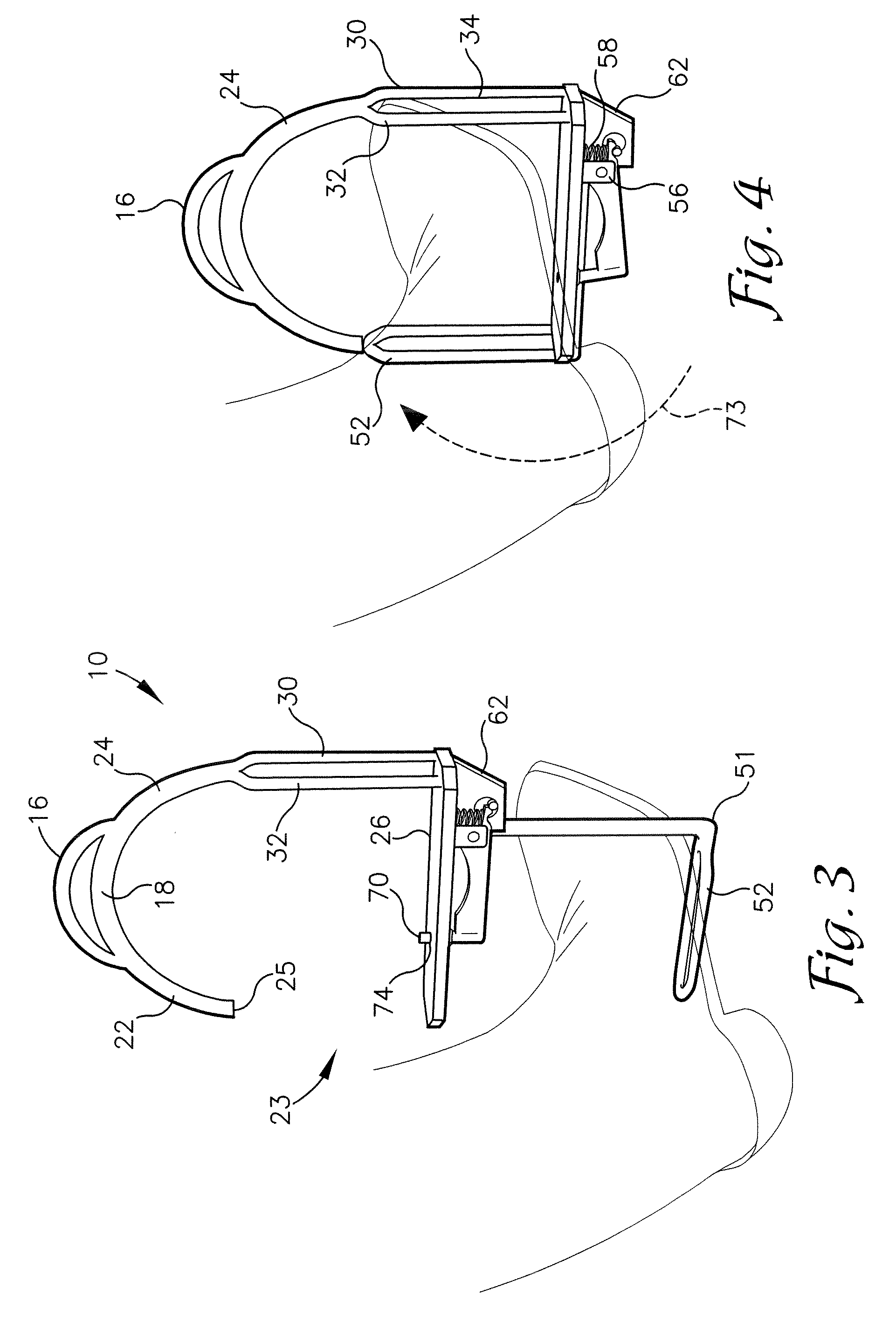 Stirrup assembly