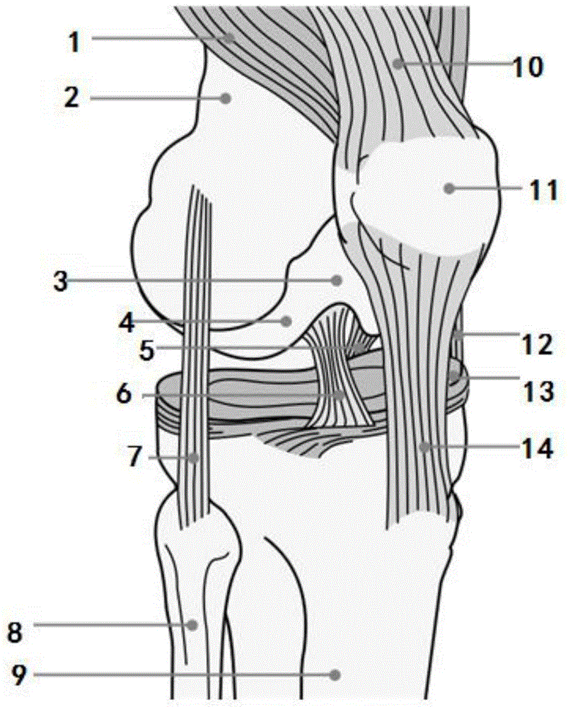 Electrode phototherapeutic instrument against arthritis