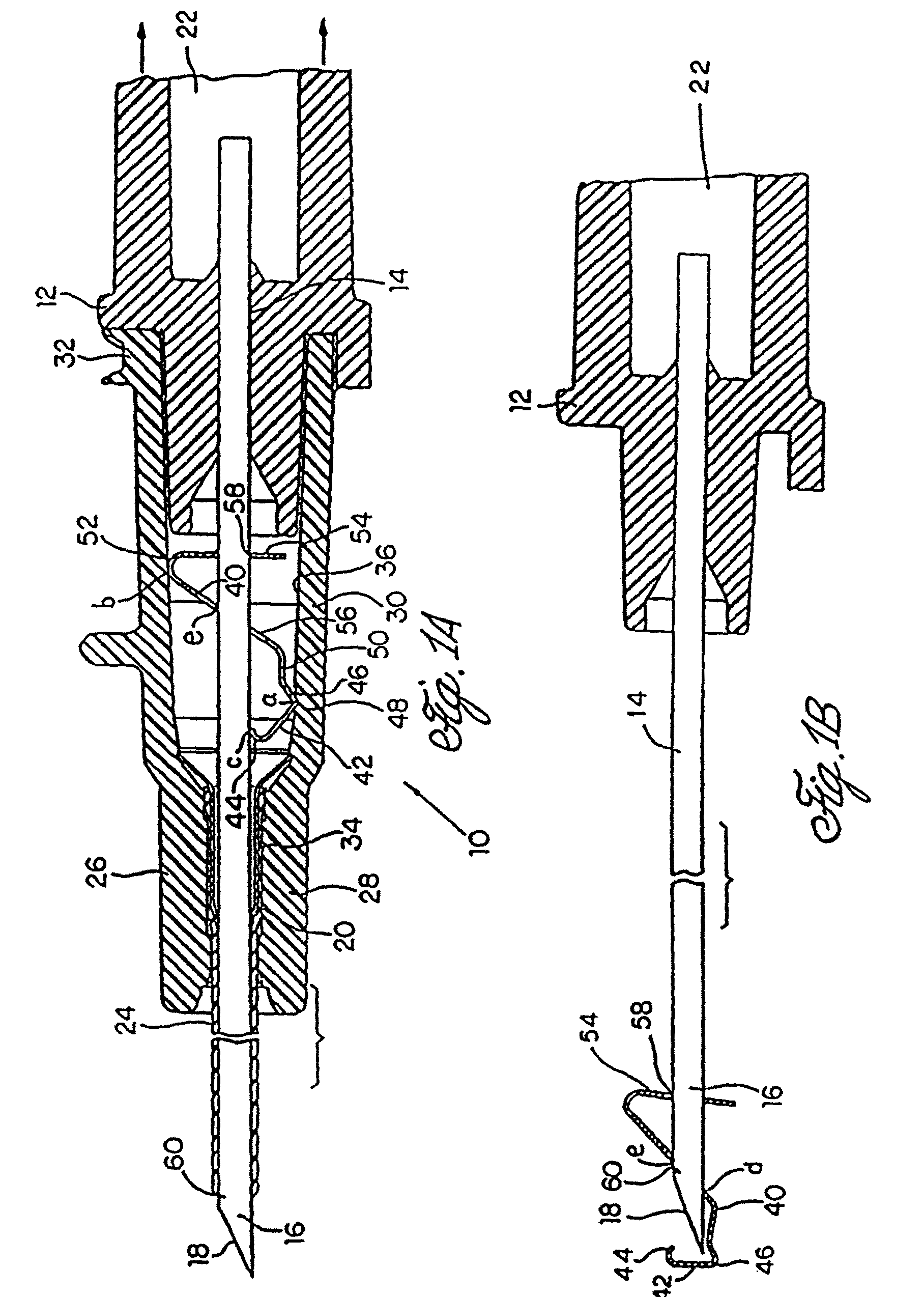 Spring clip safety IV catheter