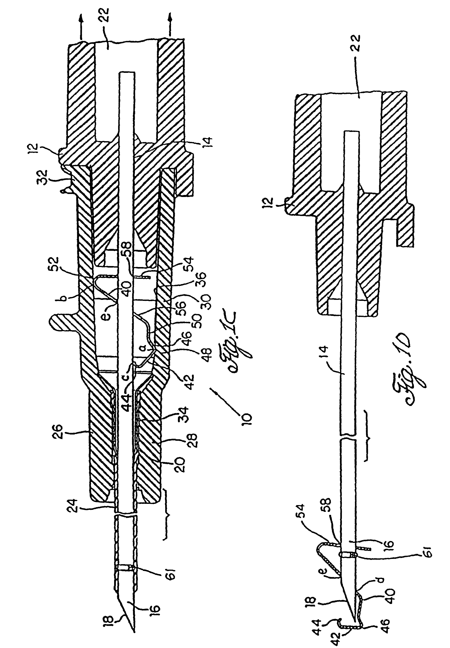 Spring clip safety IV catheter