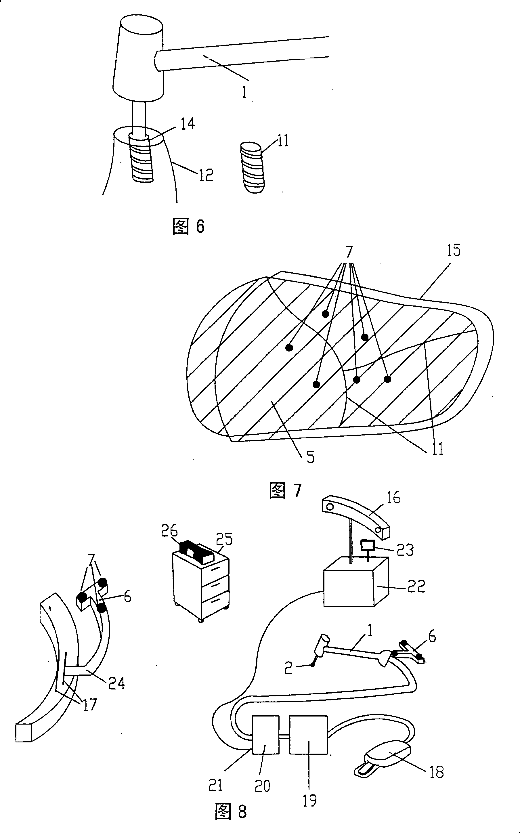 Method and device system for removing material or for working material