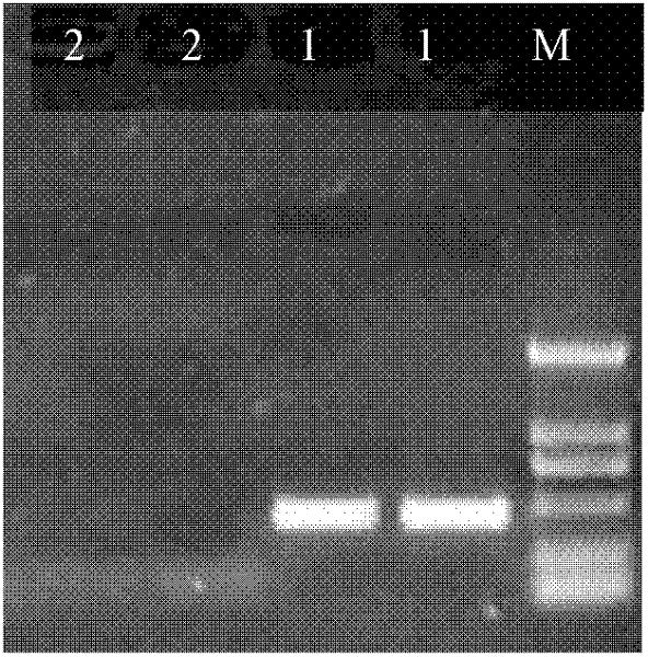 PCR (Polymerase Chain Reaction) kit and primers for detecting swine dysentery