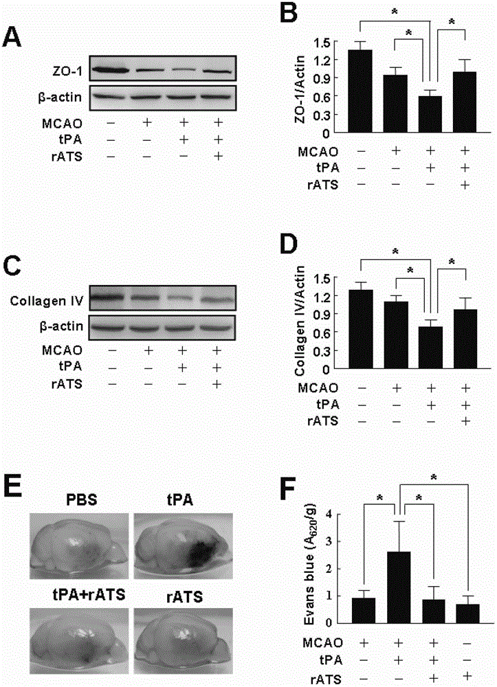 Use of recombinant adamts13 in the preparation of intracerebral hemorrhage drugs