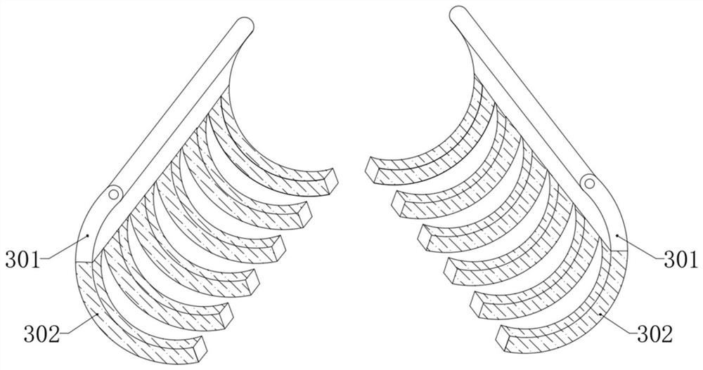 A kind of extravascular stent for kidney transplantation