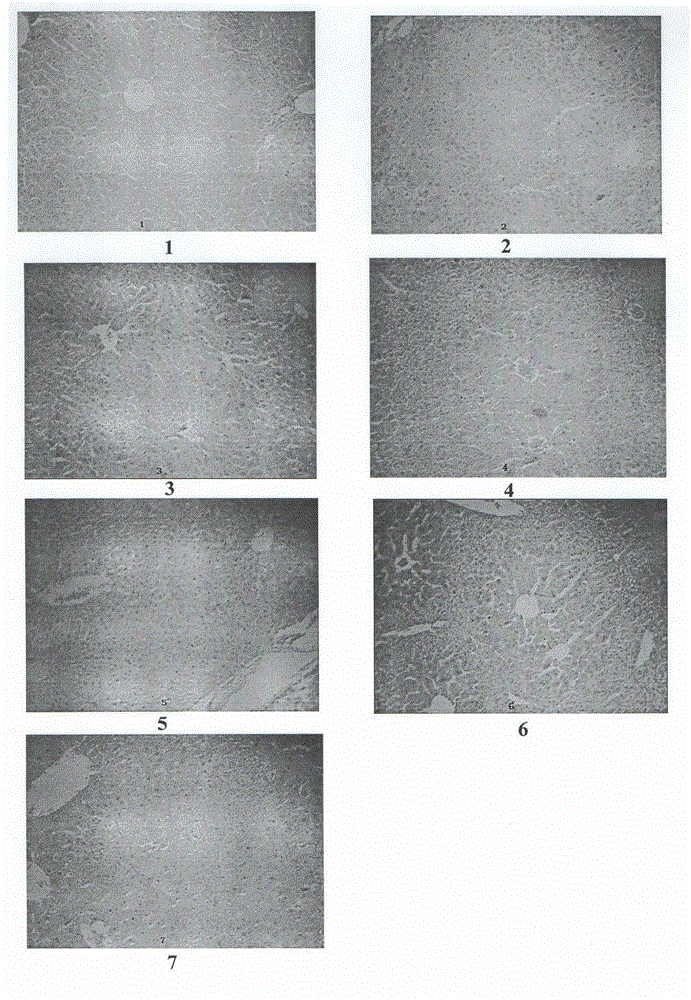 Compound medicament for treating chronic liver disease and preparation method thereof