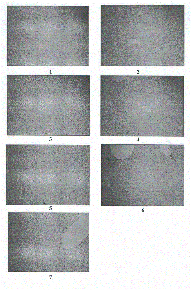 Compound medicament for treating chronic liver disease and preparation method thereof