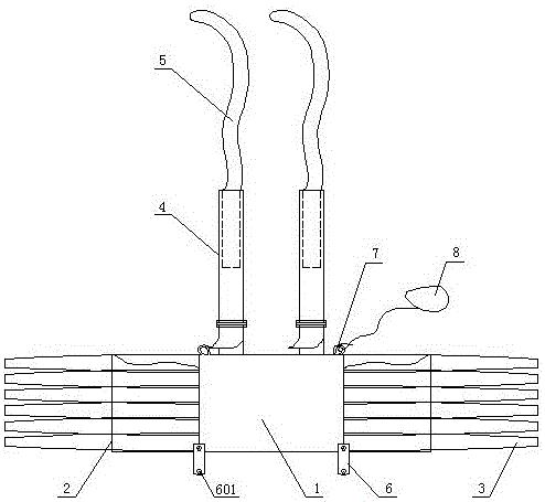 Chest fixing band