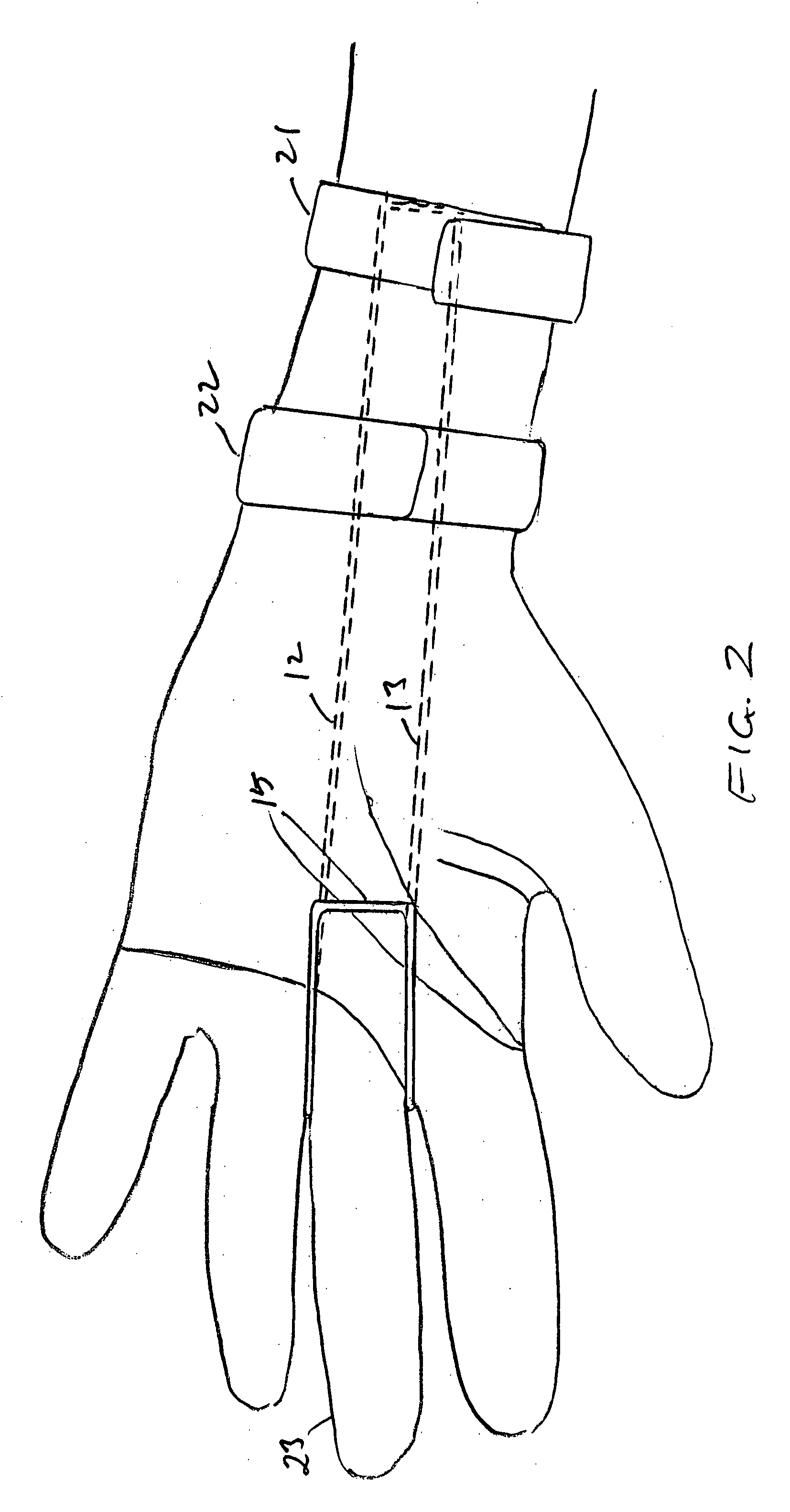 Wrist splint allowing freedom of motion for fingers and thumb