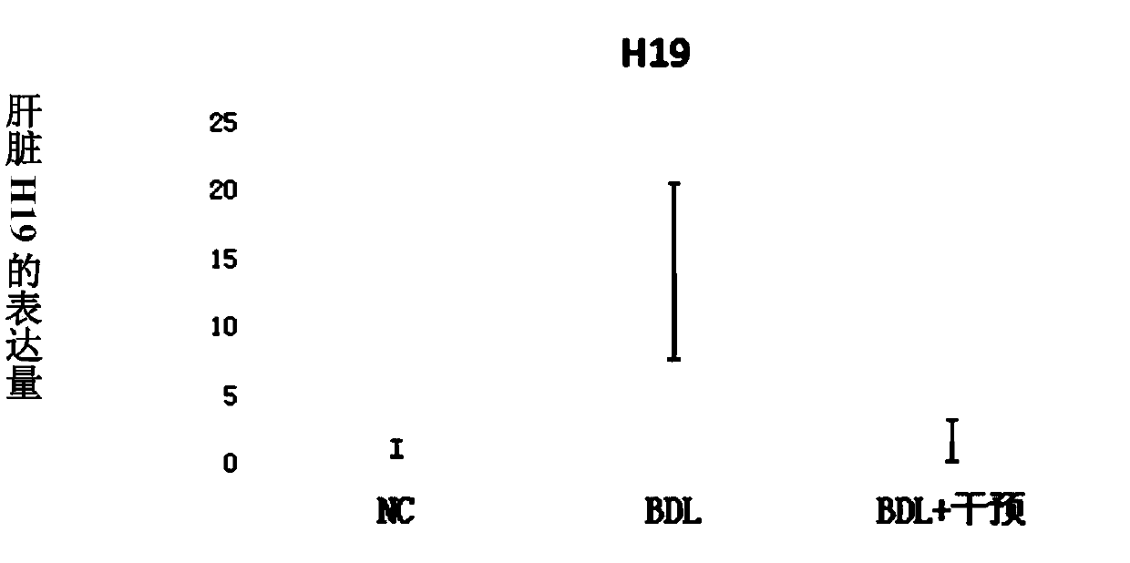 Application of butyric acid compounds in inhibiting long-chain non-coding RNA-H19