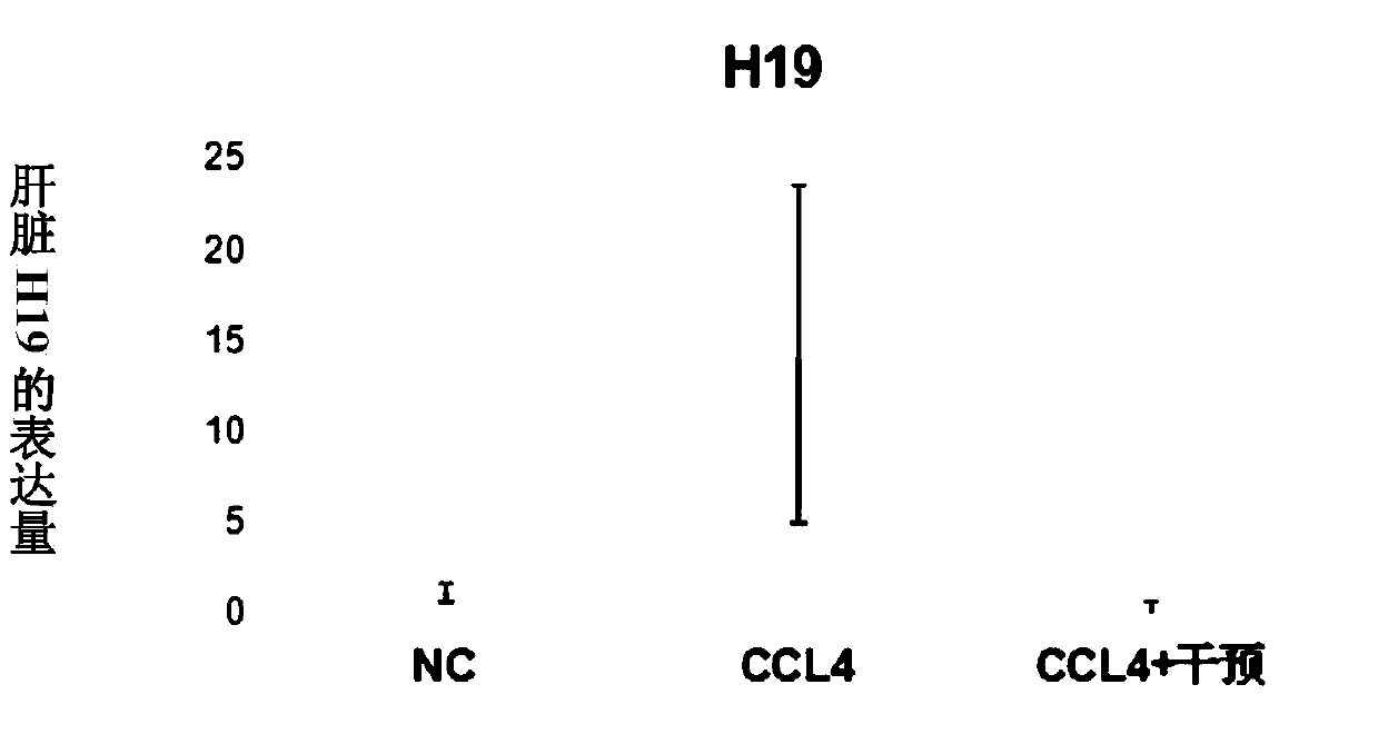 Application of butyric acid compounds in inhibiting long-chain non-coding RNA-H19