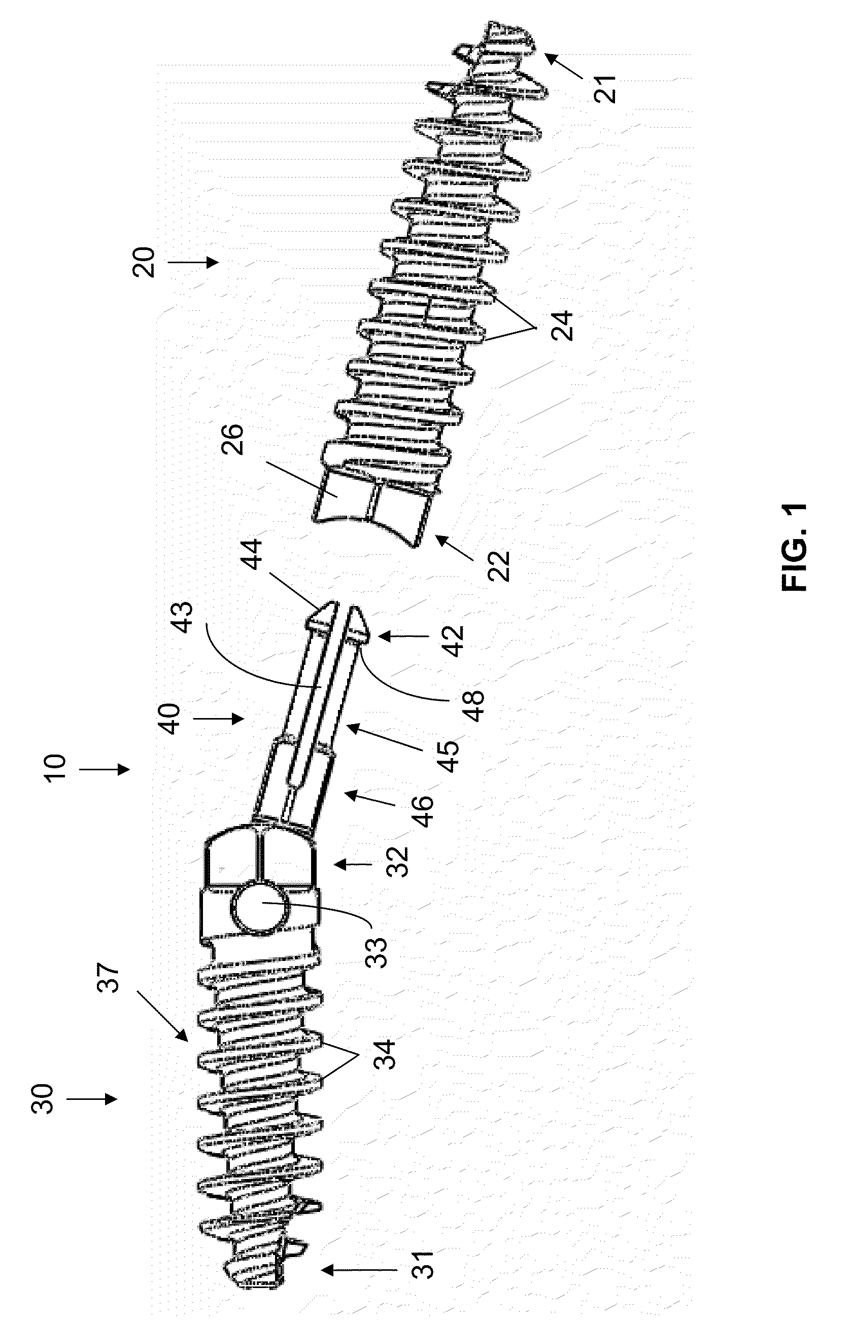 Bone joining apparatus and method