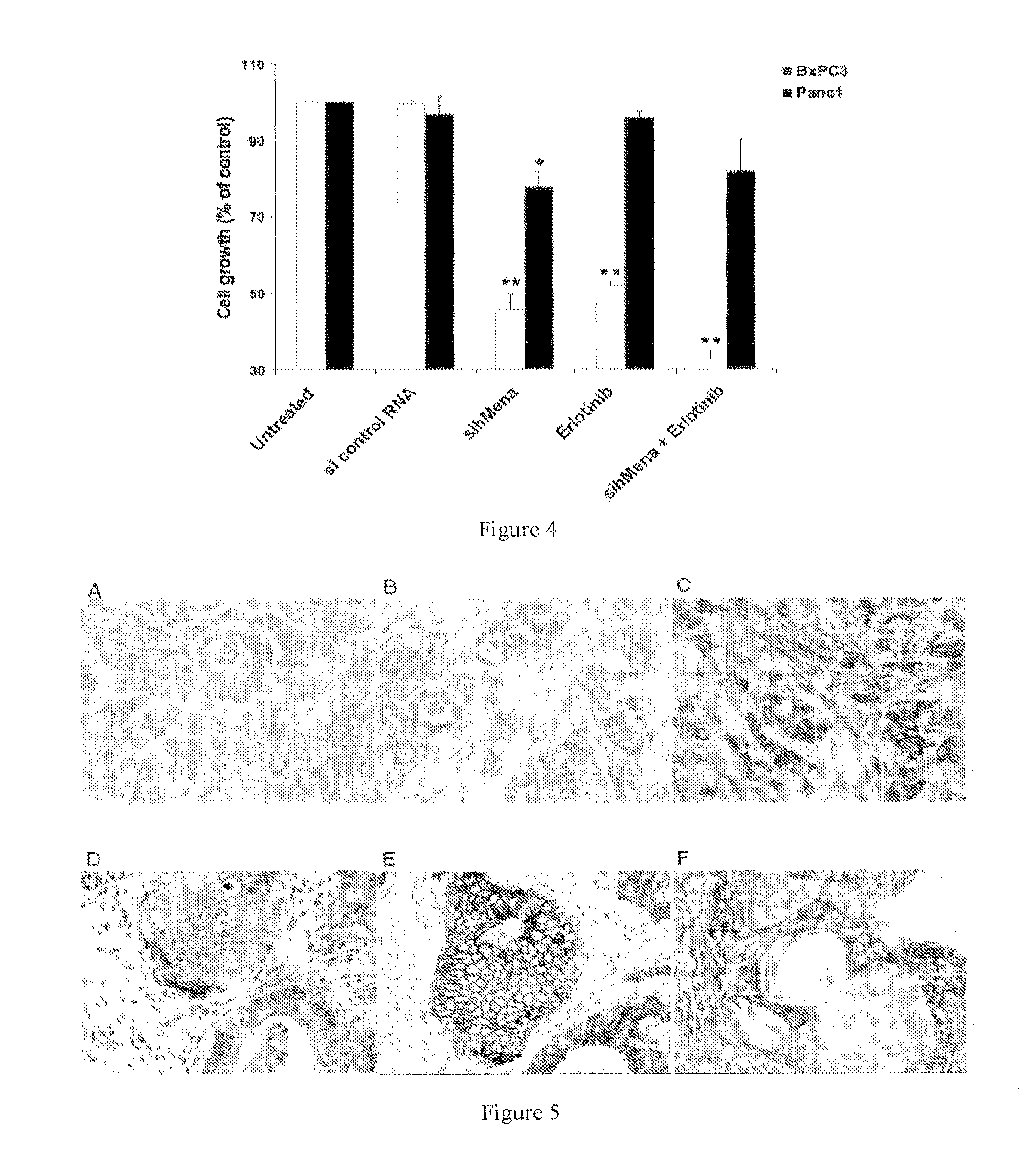 Human mena isoforms serve as markers of epithelial to mesenchymal transition and sensitivity to EGFR inhibition in human cancer cells