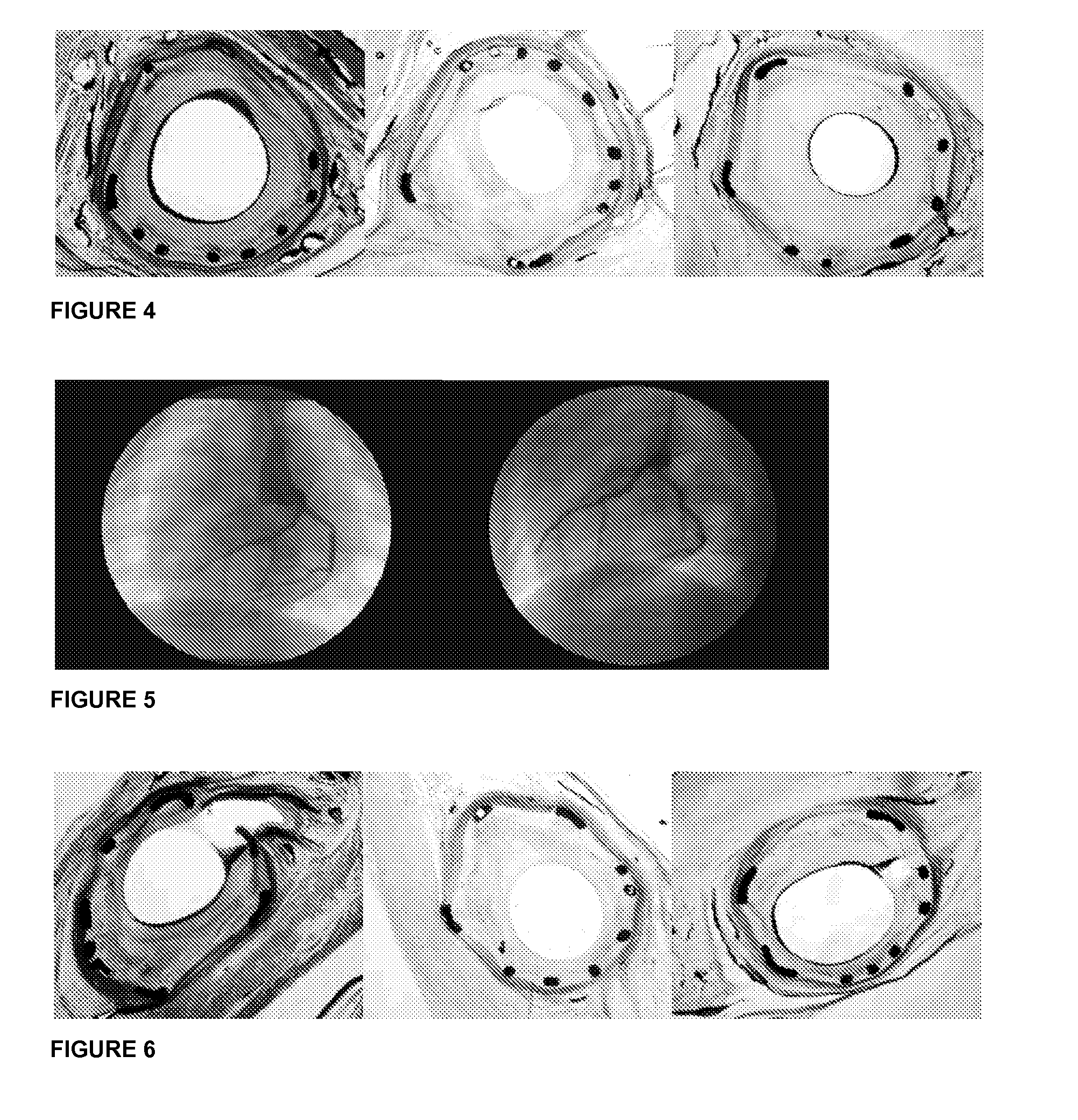 Medical stent provided with a combination of melatonin and paclitaxel