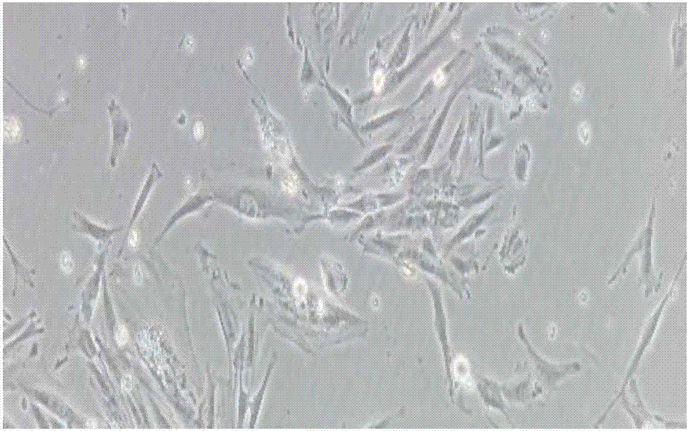 Method for realizing separation and in-vitro proliferation of stem cells from exfoliated deciduous teeth