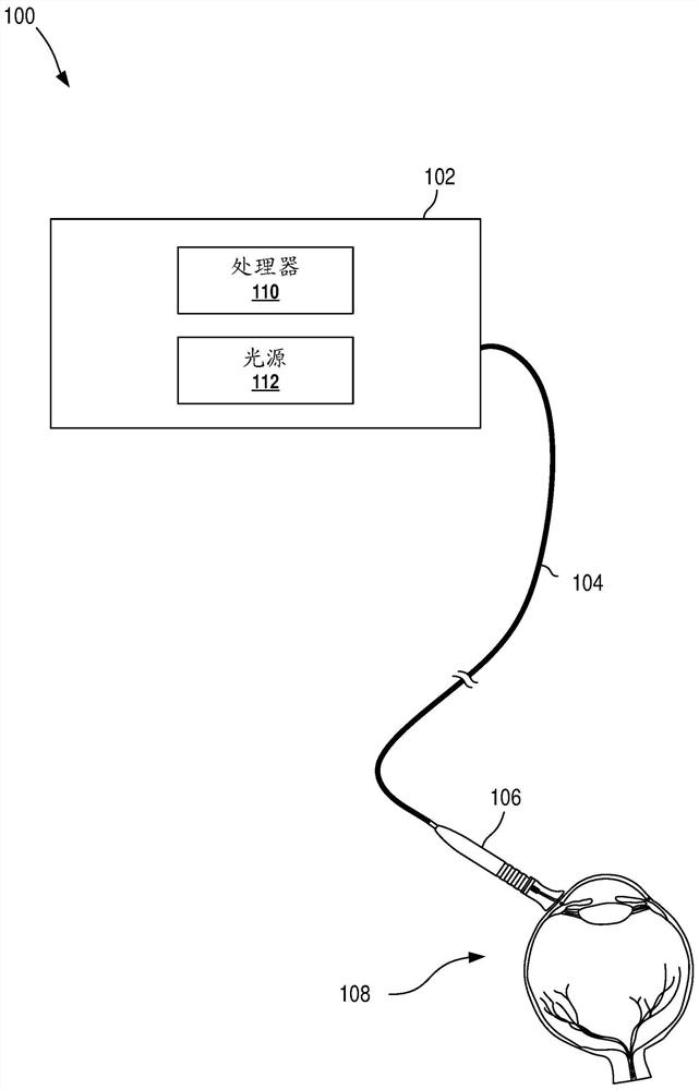 Paralimbal laser probe