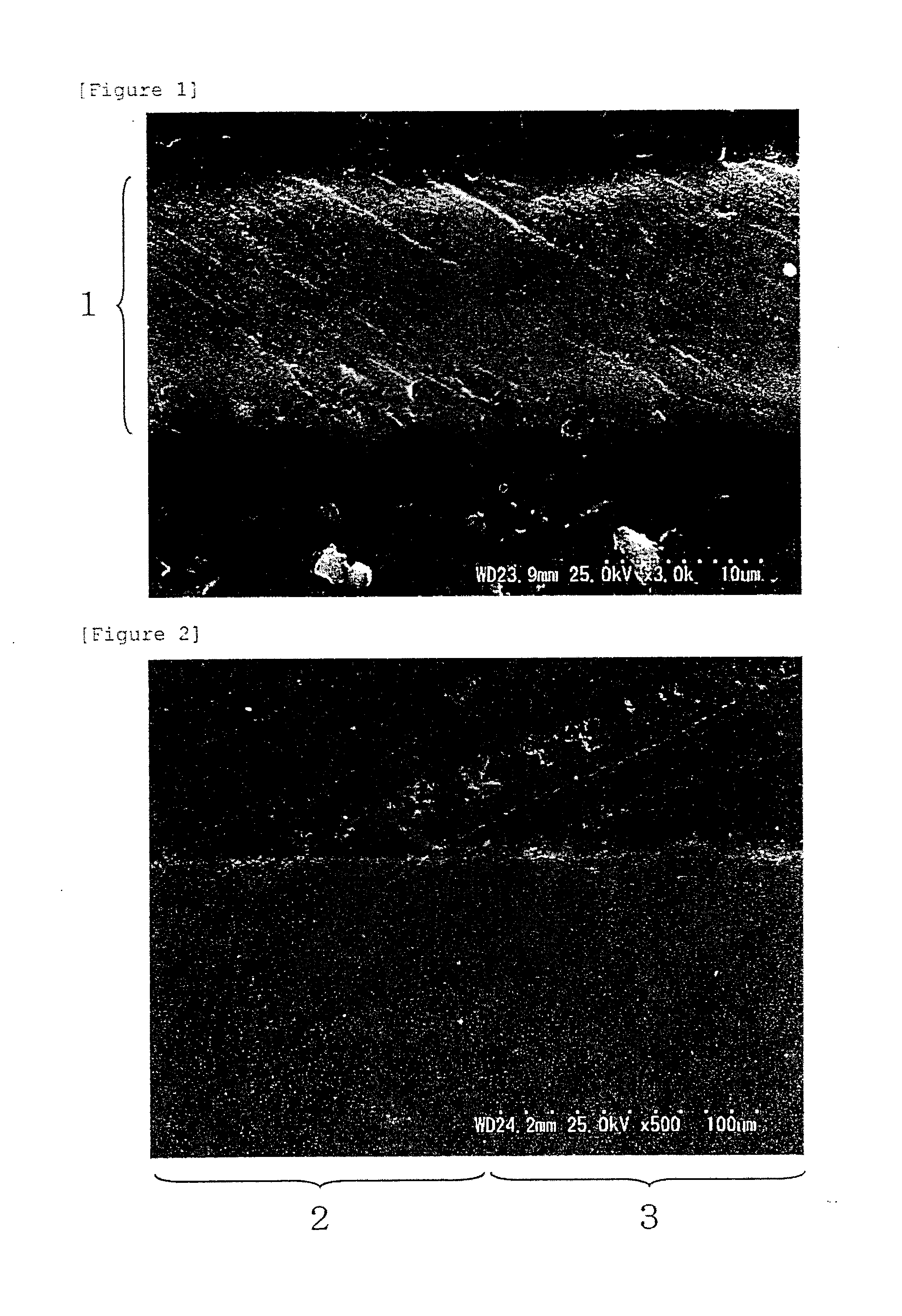 Method for inhibiting dentinal hypersensitivity